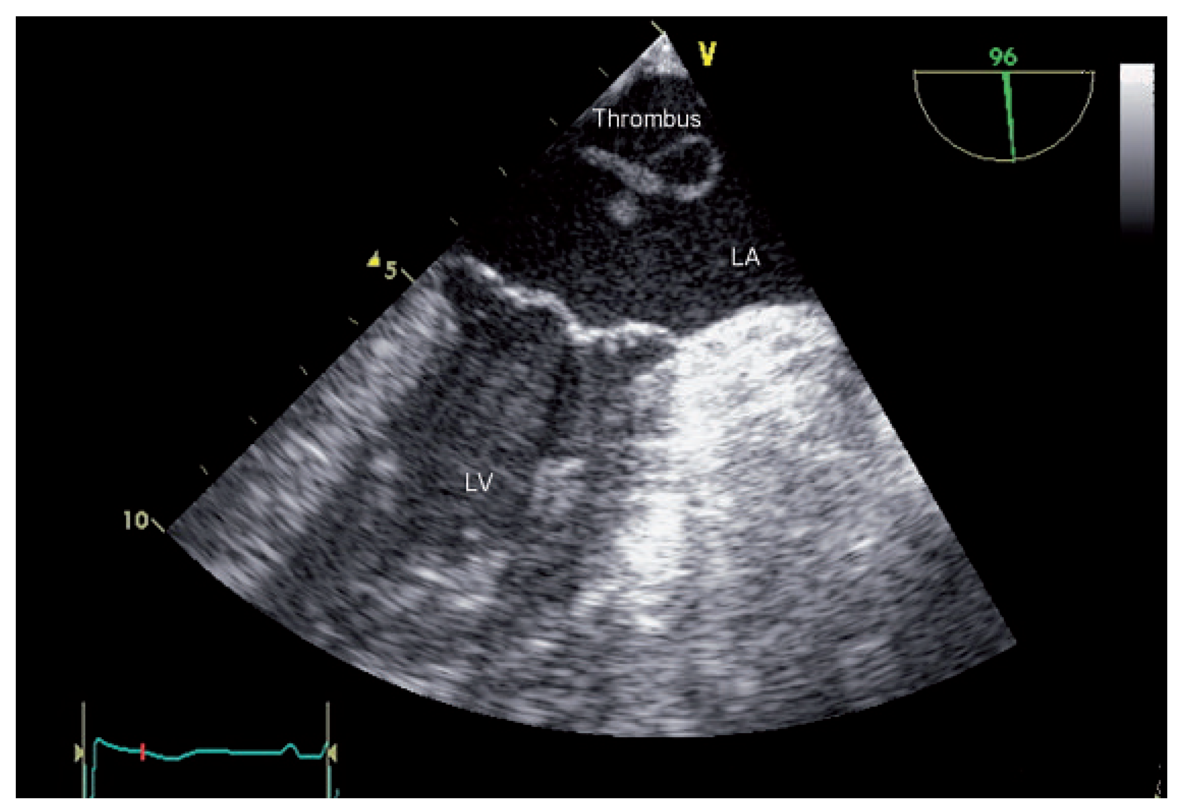 Cardiovascmed 14 00229 g002 Cardiovascmed 14 00229 g002