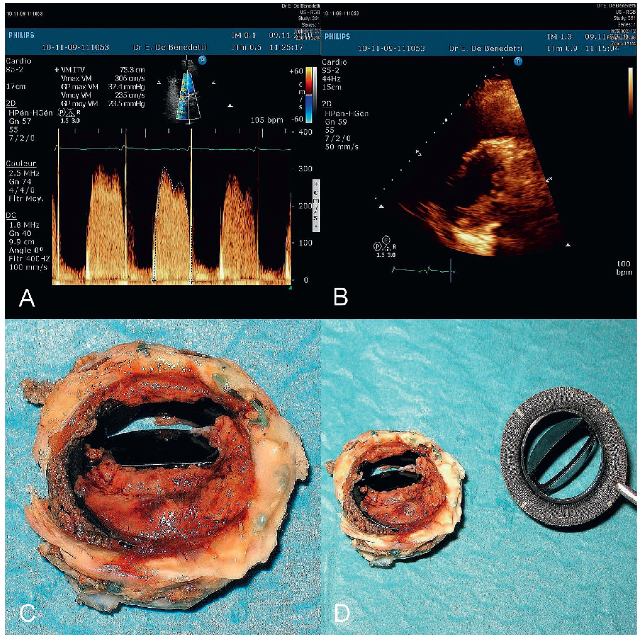 Cardiovascmed 14 00230 g001