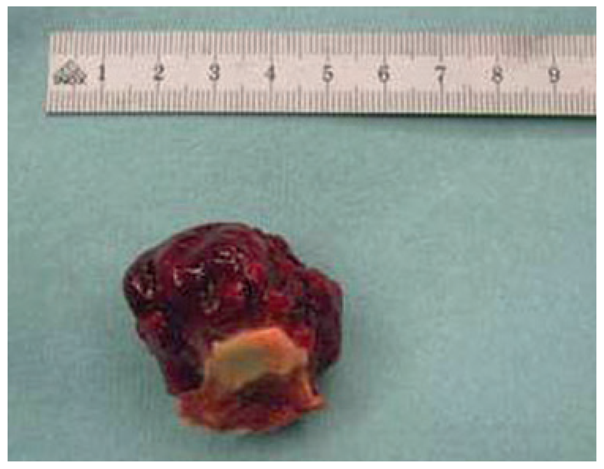 Cardiovascmed 14 00242 g002 Cardiovascmed 14 00242 g002