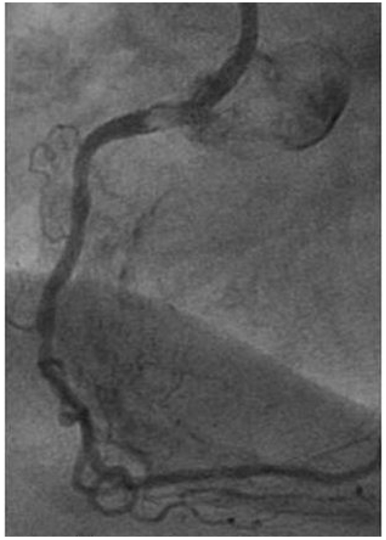 Cardiovascmed 14 00242 g003 Cardiovascmed 14 00242 g003