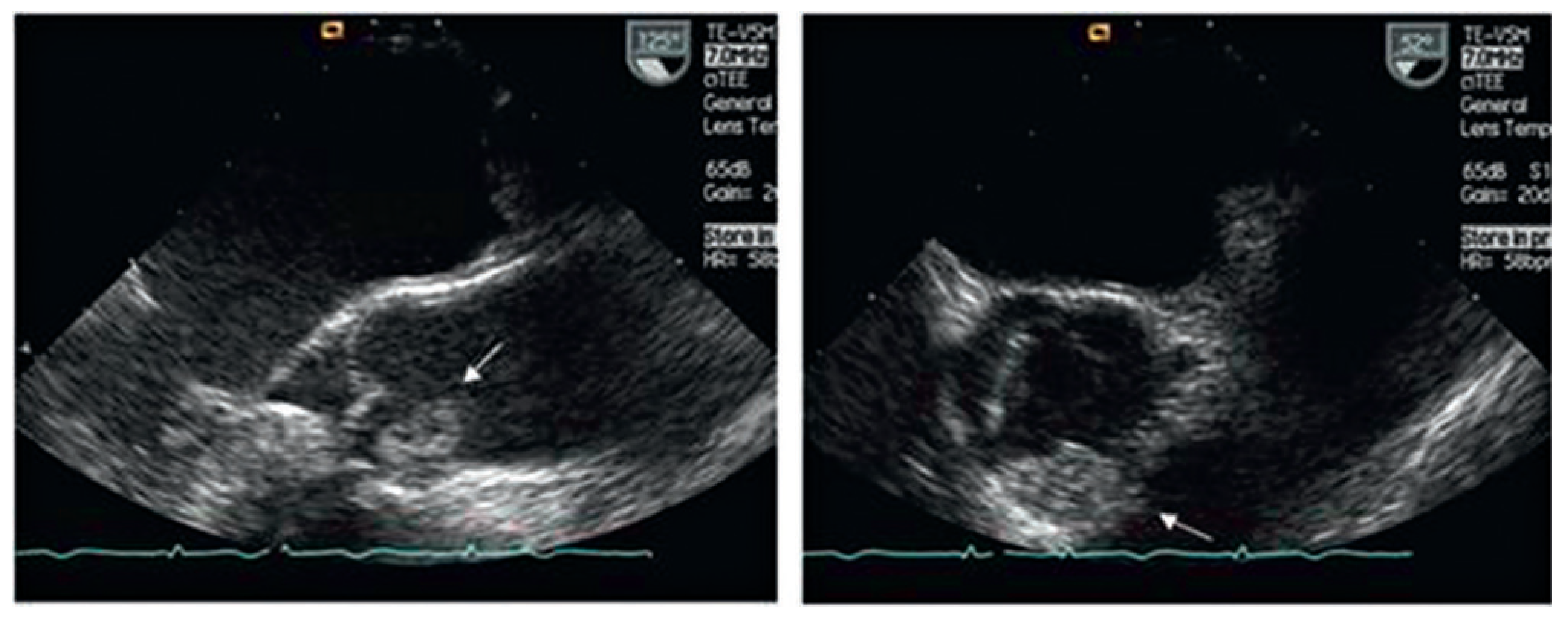 Cardiovascmed 14 00242 g004 Cardiovascmed 14 00242 g004