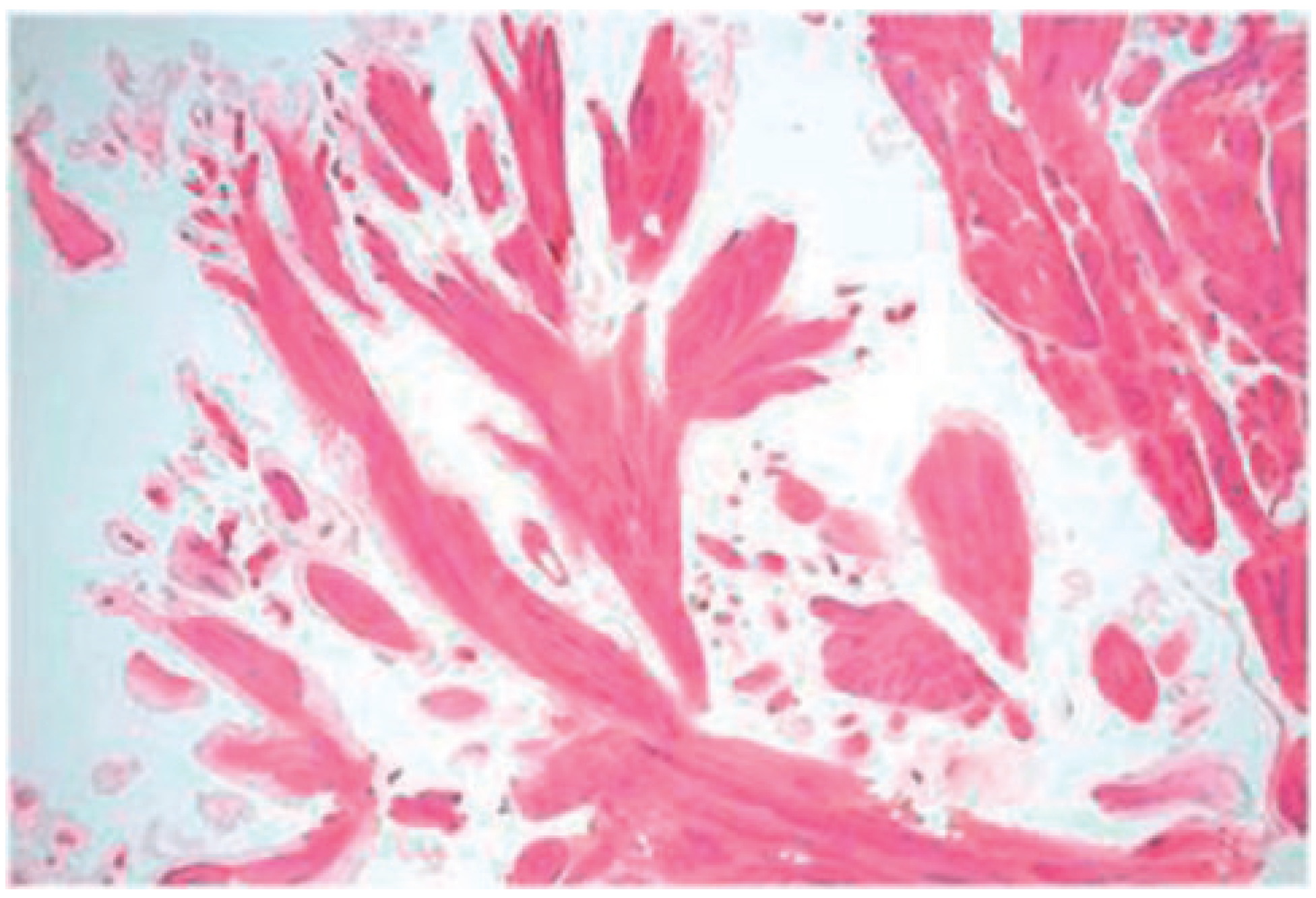 Cardiovascmed 14 00242 g006 Cardiovascmed 14 00242 g006