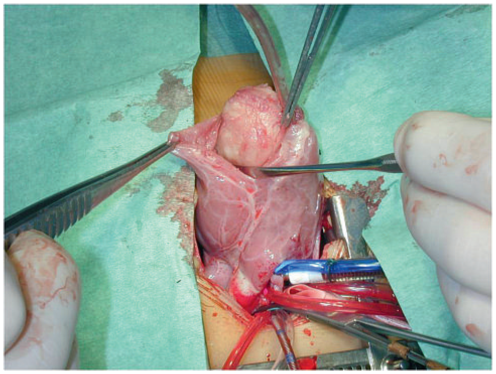 Cardiovascmed 14 00242 g007 Cardiovascmed 14 00242 g007