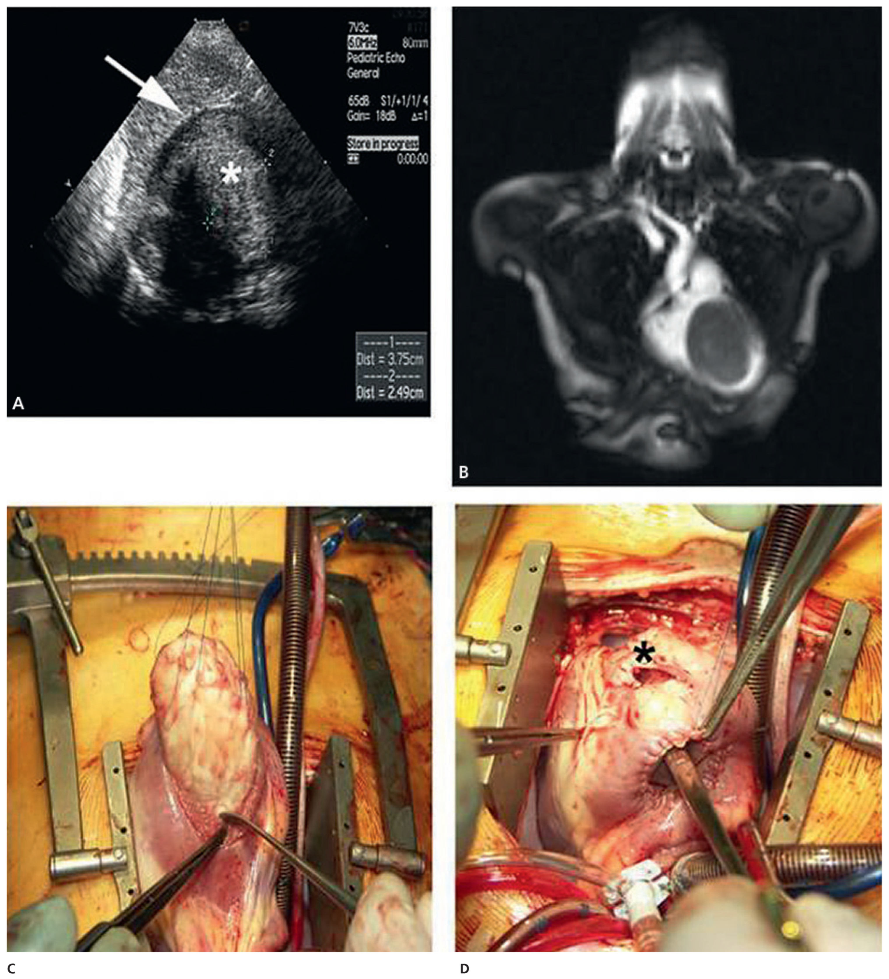 Cardiovascmed 14 00242 g008 Cardiovascmed 14 00242 g008