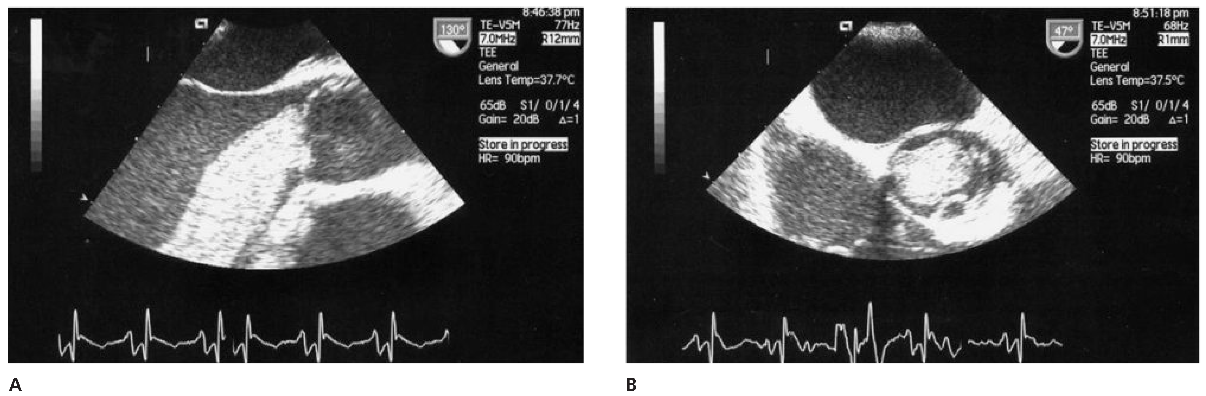 Cardiovascmed 14 00242 g009 Cardiovascmed 14 00242 g009