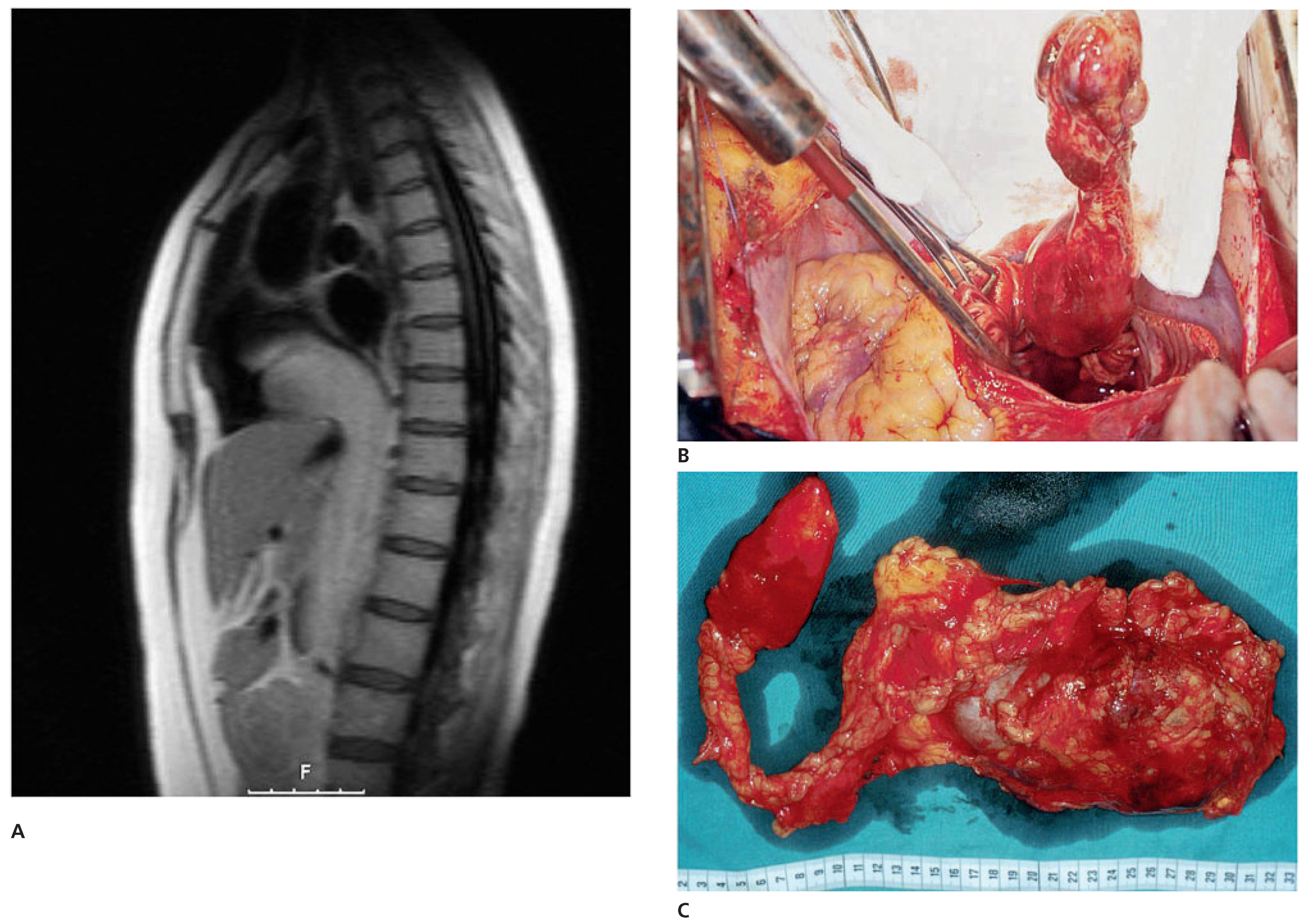 Cardiovascmed 14 00242 g010 Cardiovascmed 14 00242 g010