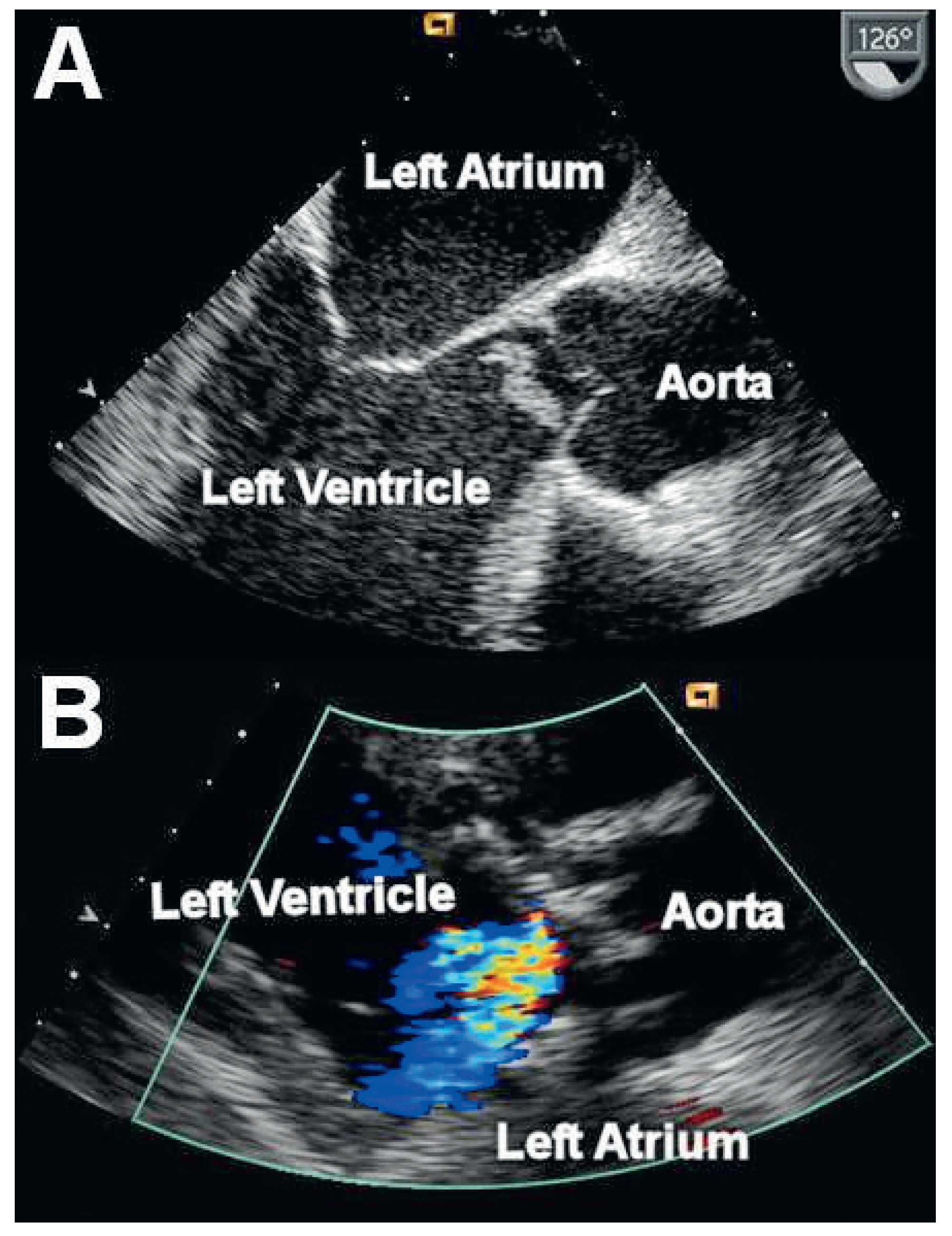 Cardiovascmed 14 00264 g001 Cardiovascmed 14 00264 g001