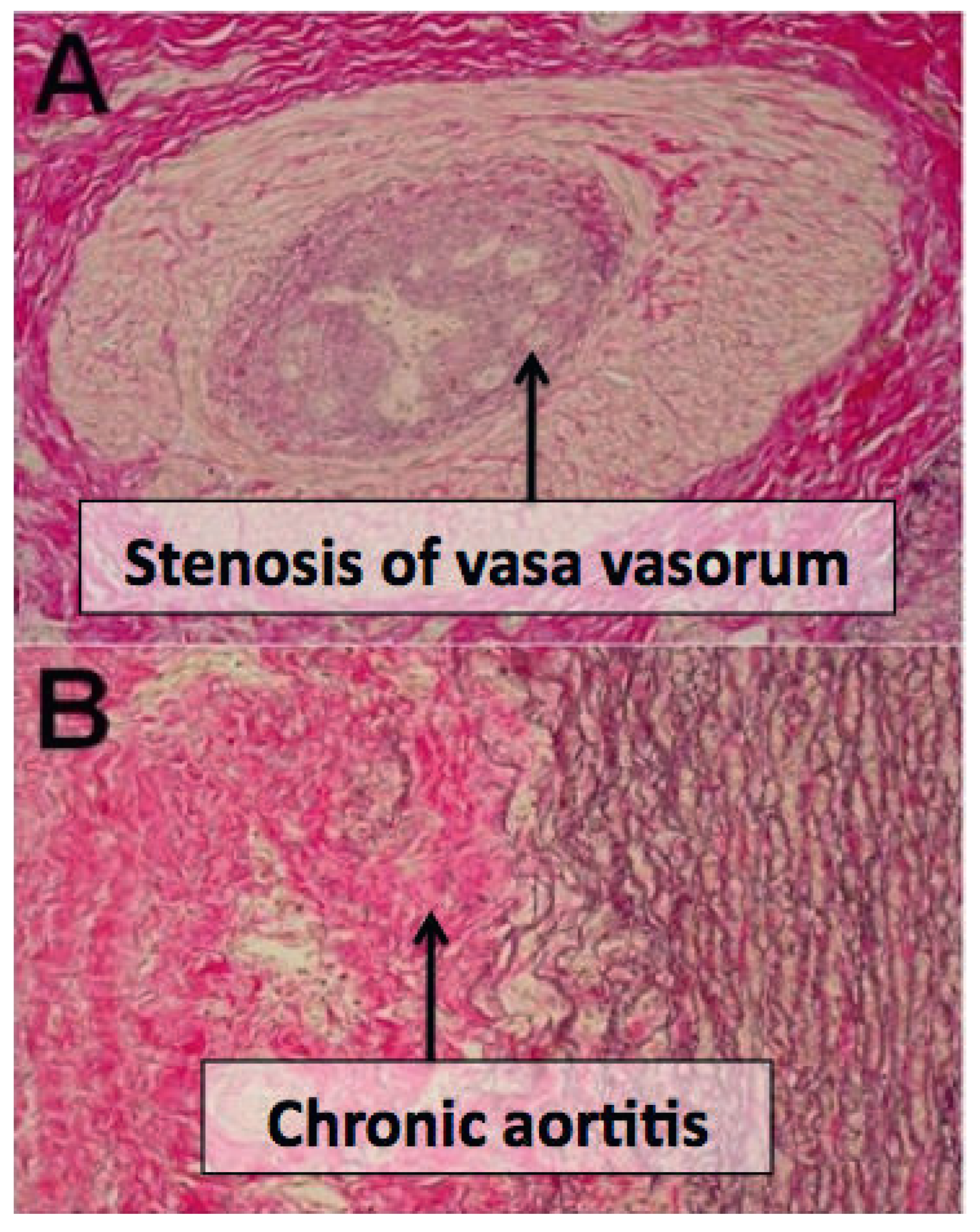Cardiovascmed 14 00264 g002 Cardiovascmed 14 00264 g002