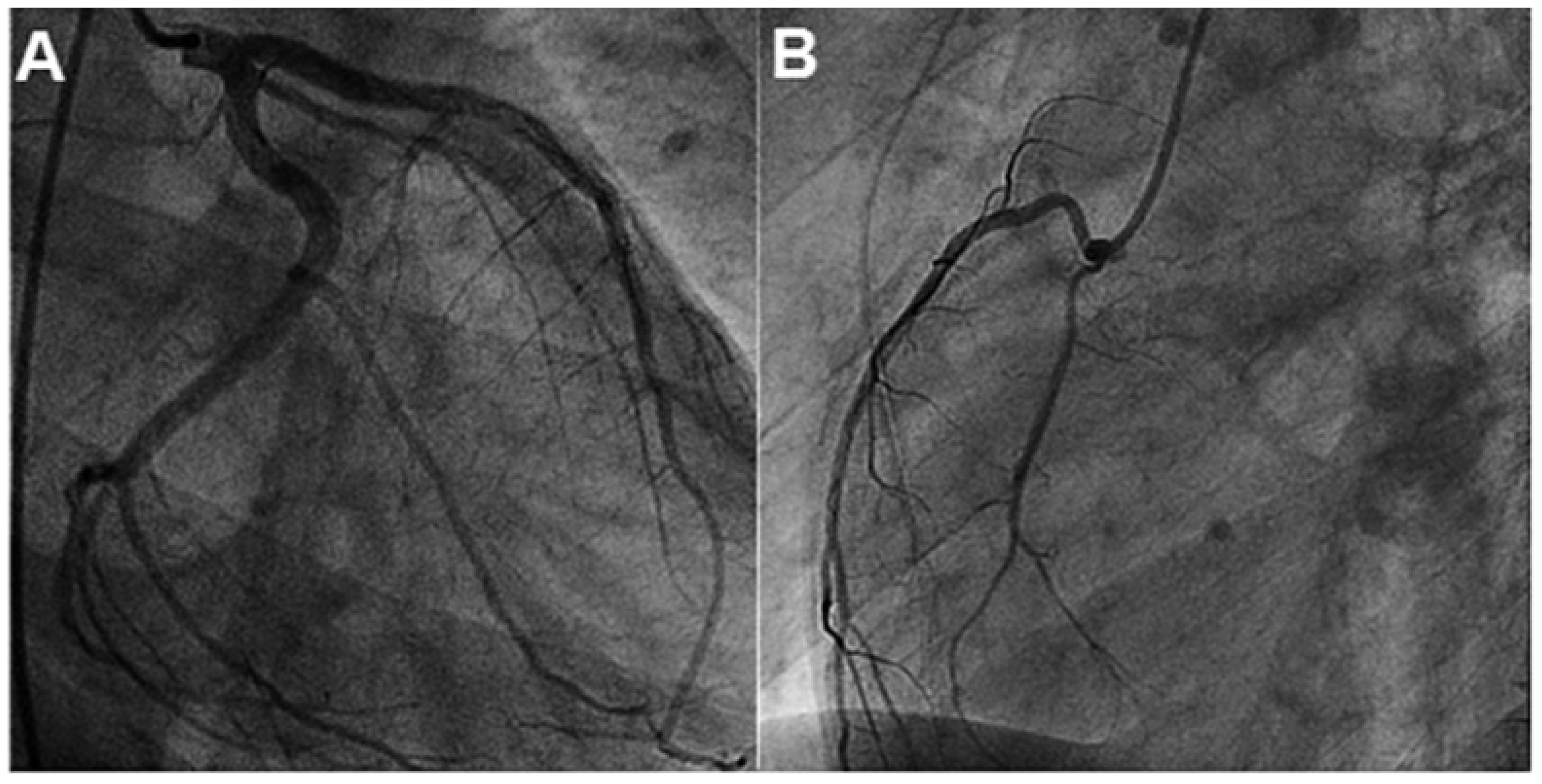 Cardiovascmed 14 00266 g001 Cardiovascmed 14 00266 g001