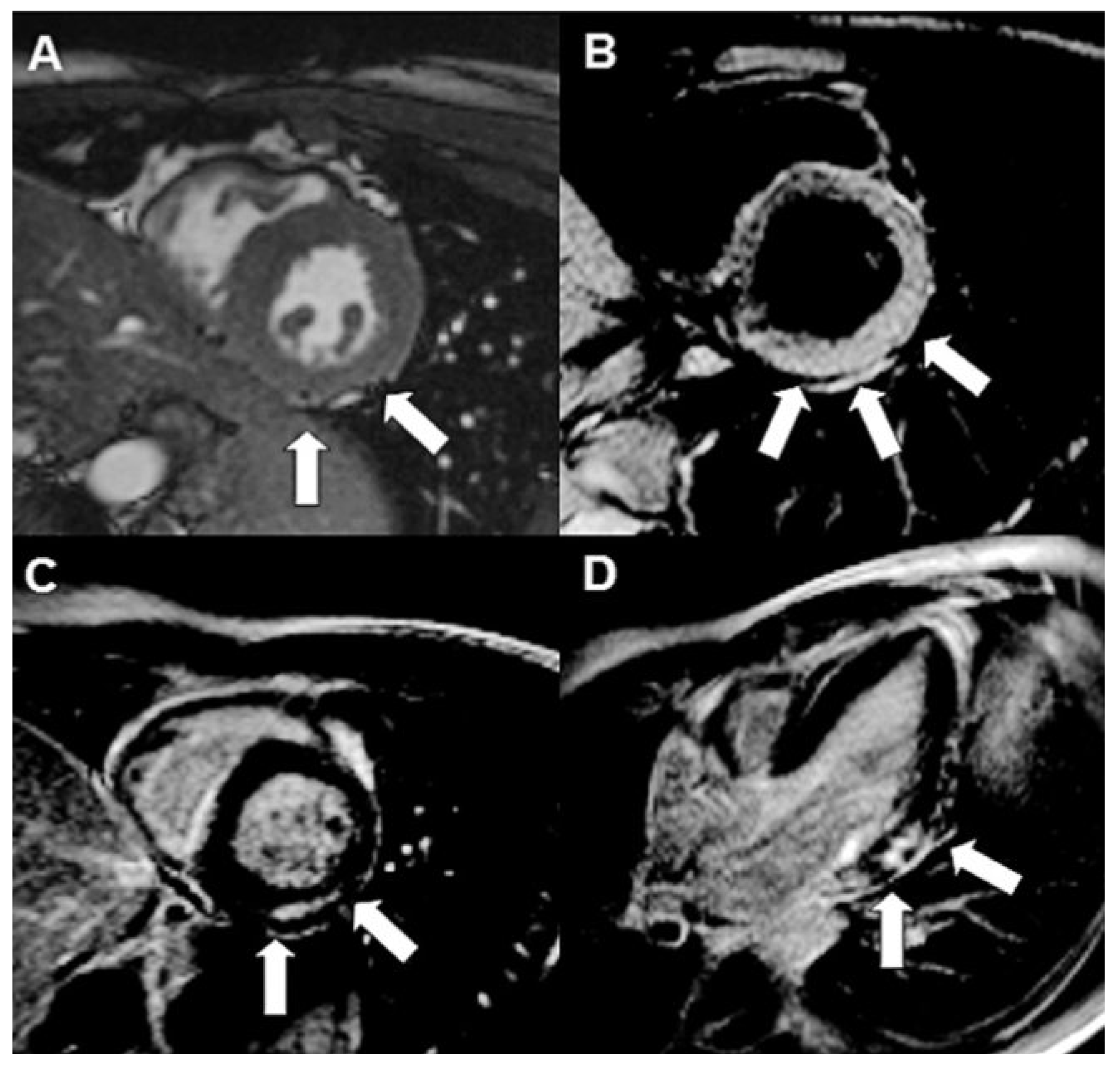 Cardiovascmed 14 00266 g002 Cardiovascmed 14 00266 g002
