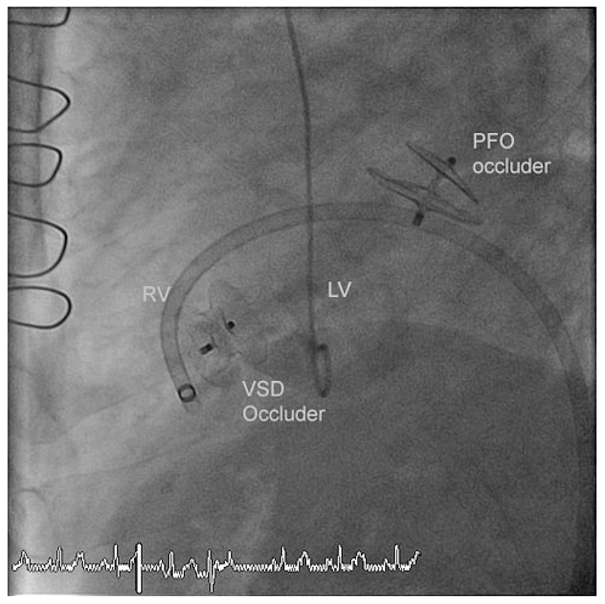 Cardiovascmed 14 00283 g003