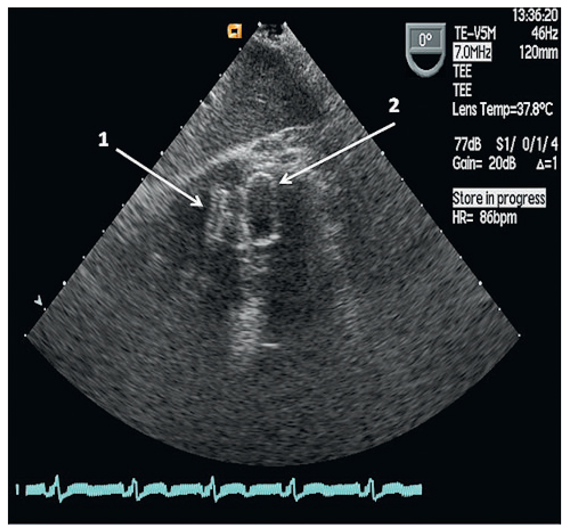 Cardiovascmed 14 00283 g004