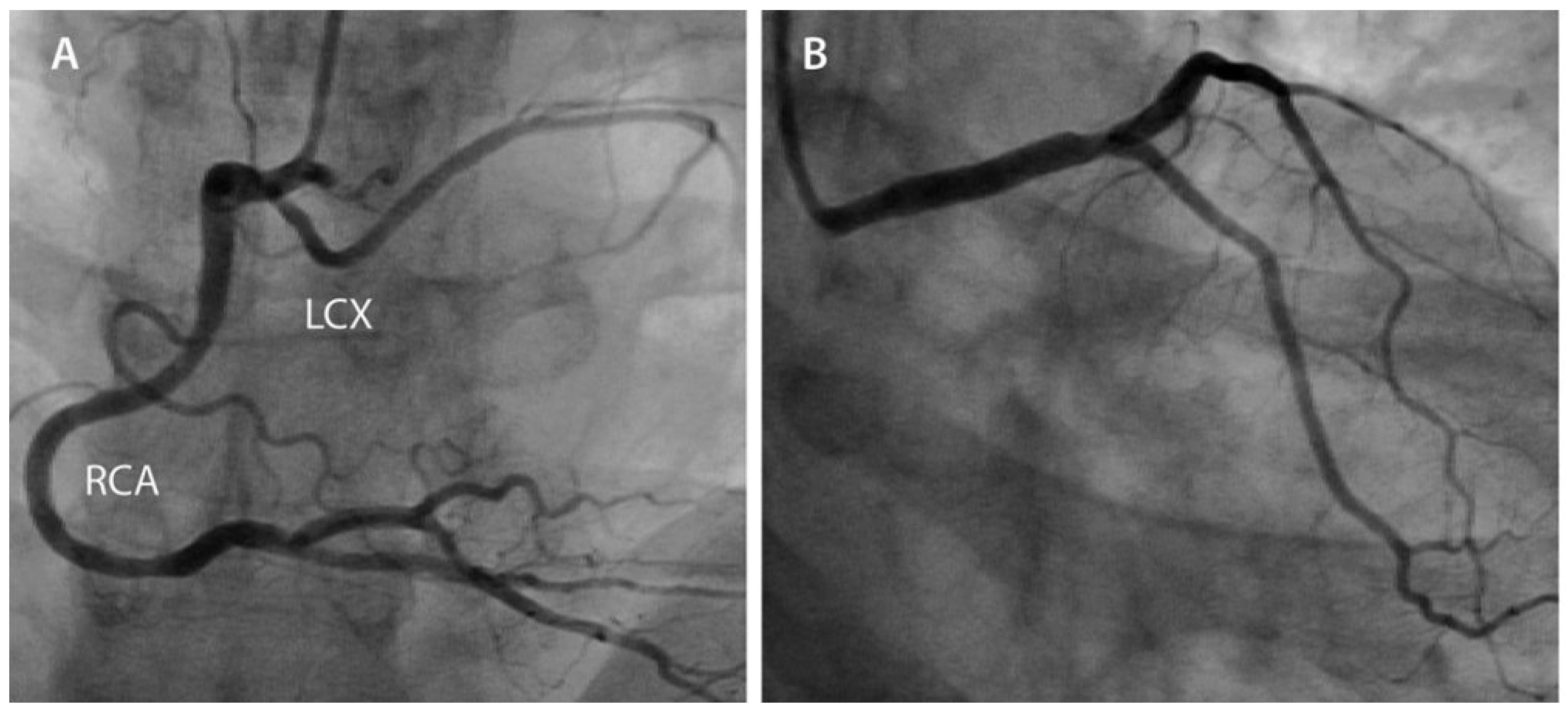 Cardiovascmed 14 00286 g002