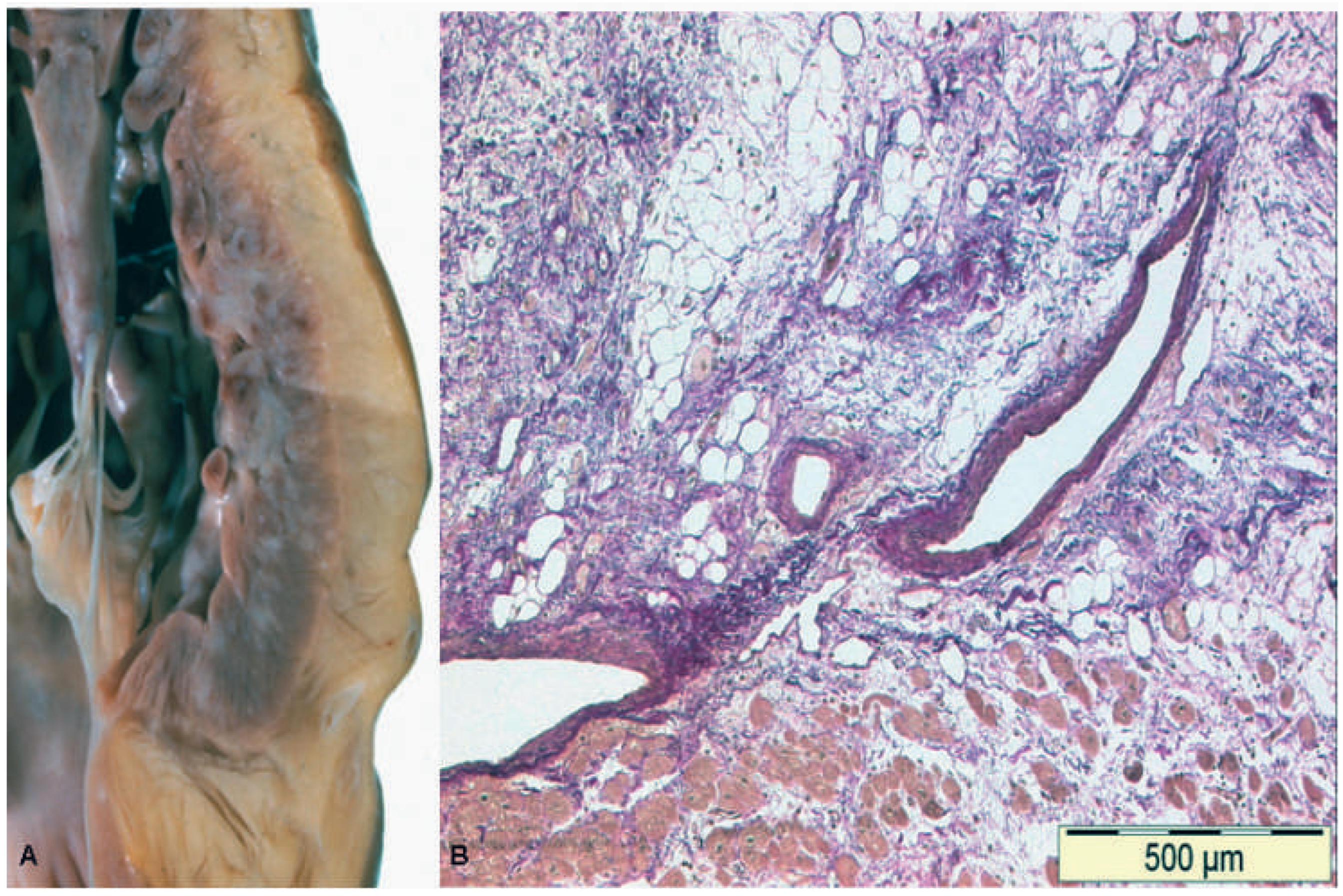 Cardiovascmed 14 00303 g001 Cardiovascmed 14 00303 g001