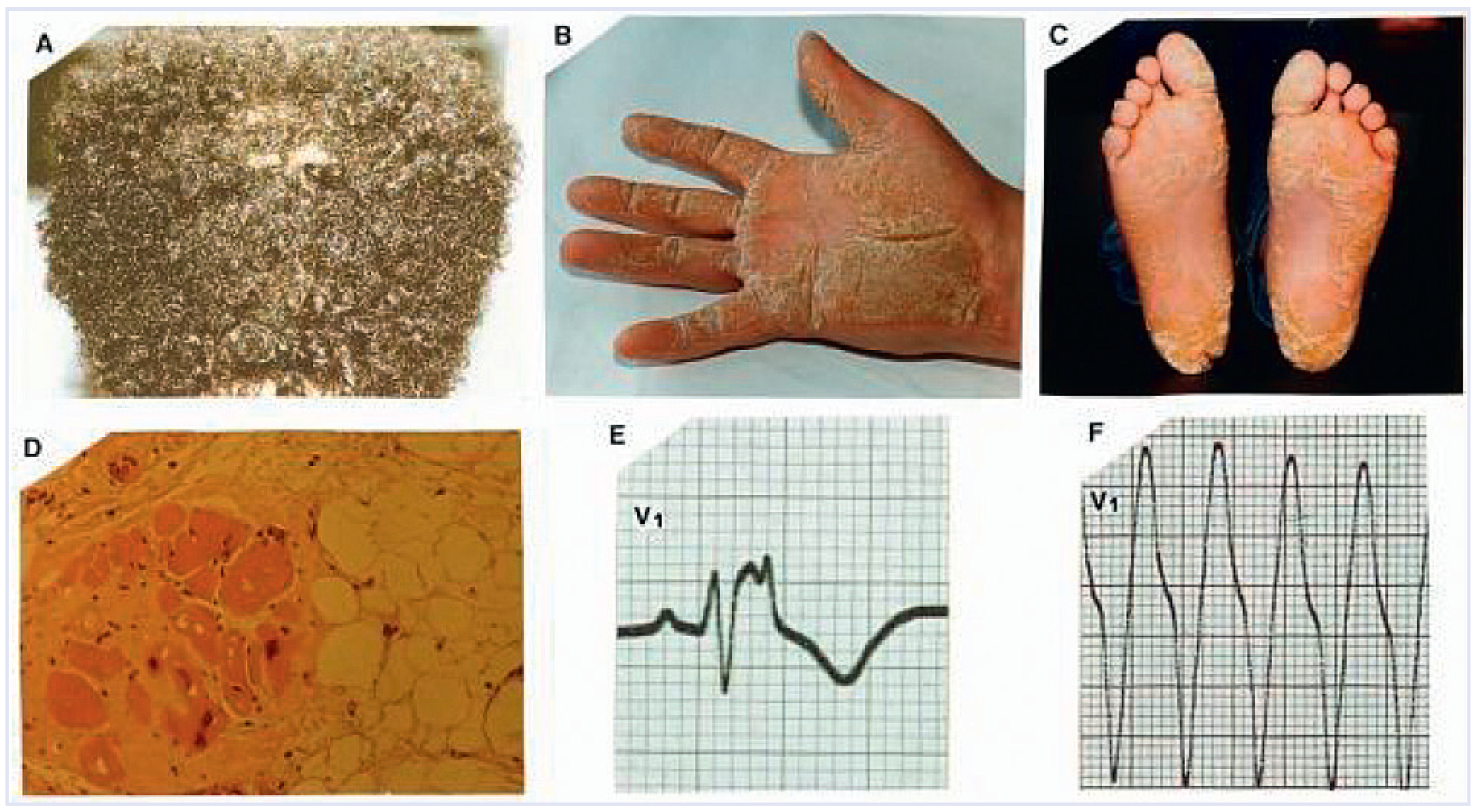 Cardiovascmed 14 00303 g003 Cardiovascmed 14 00303 g003