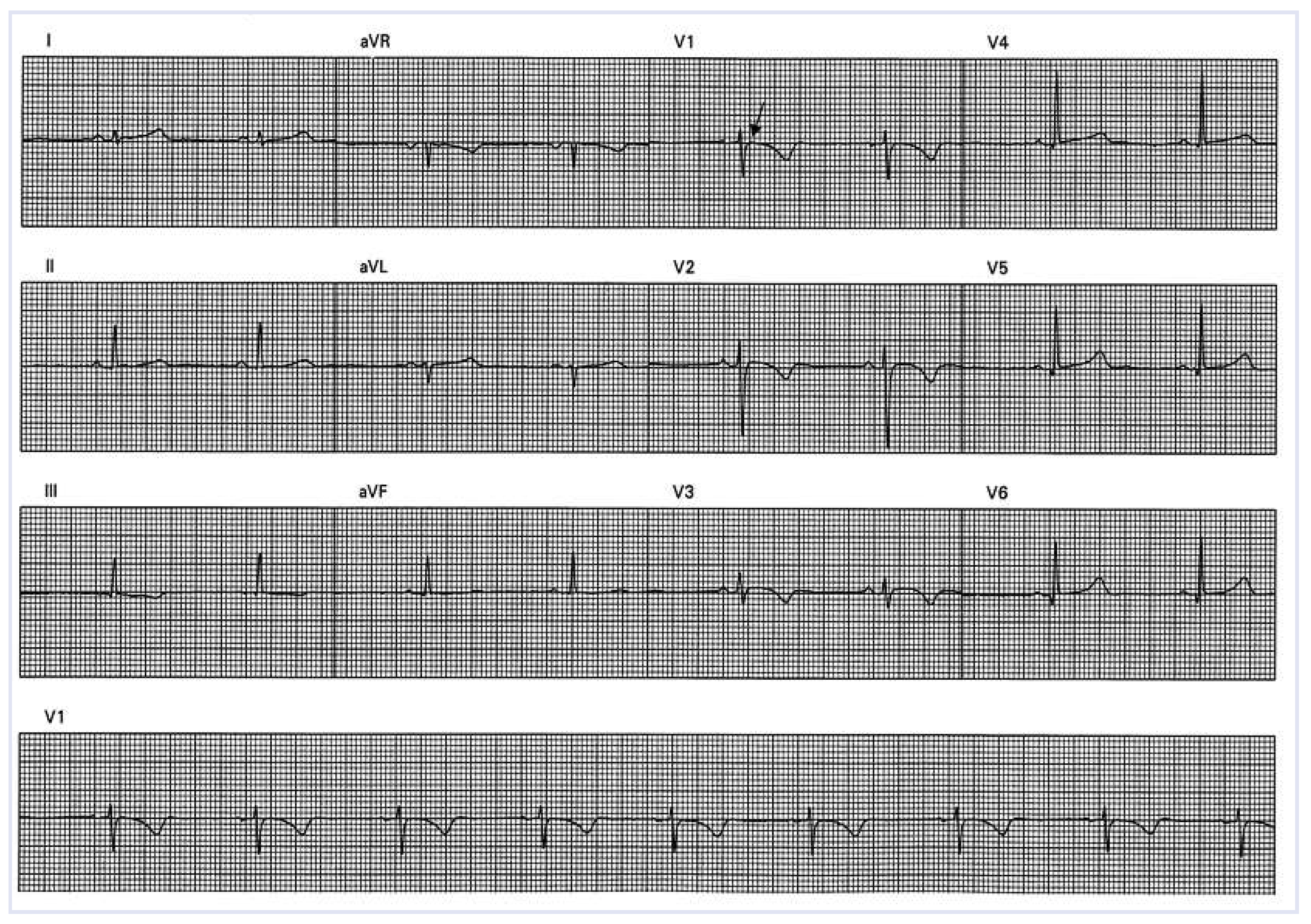 Cardiovascmed 14 00303 g004 Cardiovascmed 14 00303 g004