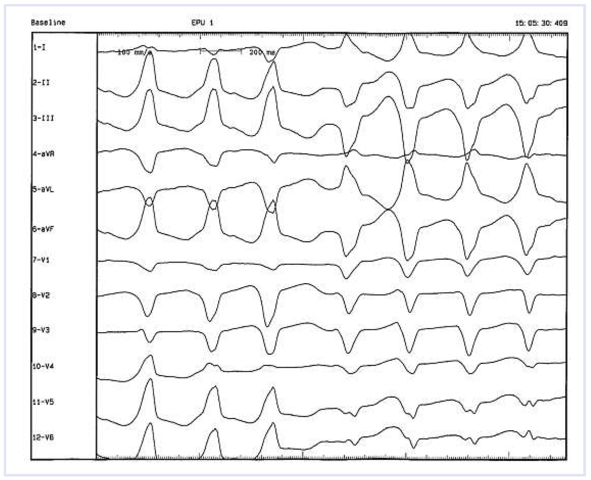 Cardiovascmed 14 00303 g005 Cardiovascmed 14 00303 g005