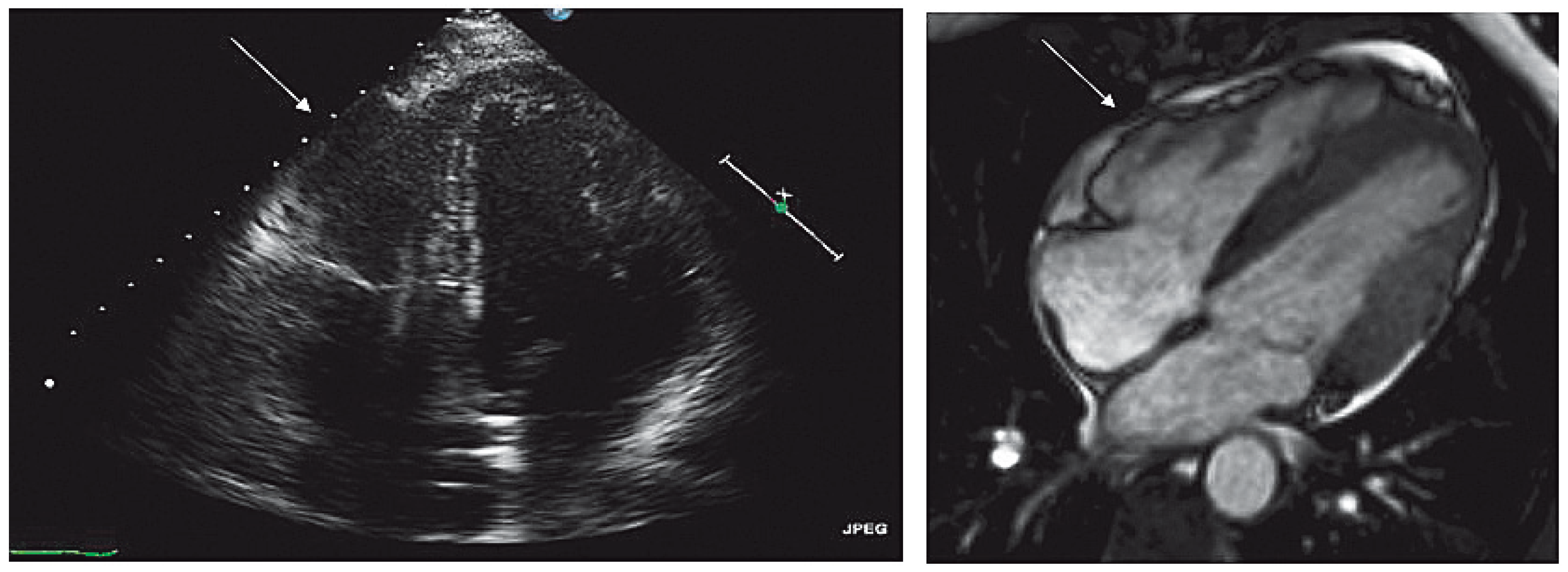 Cardiovascmed 14 00303 g006 Cardiovascmed 14 00303 g006