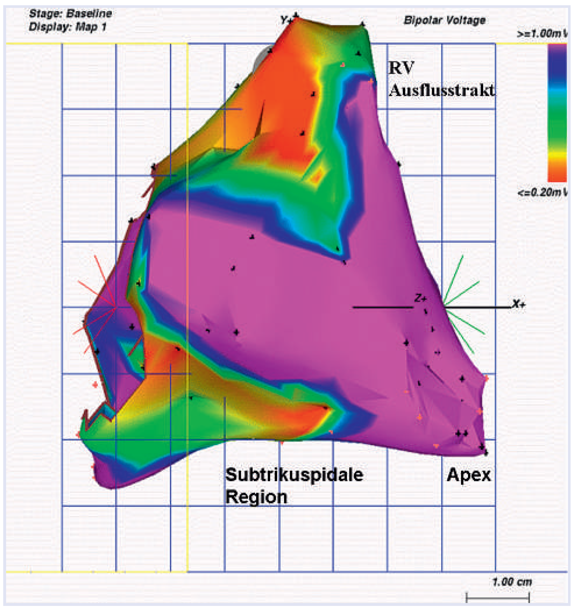 Cardiovascmed 14 00303 g007 Cardiovascmed 14 00303 g007