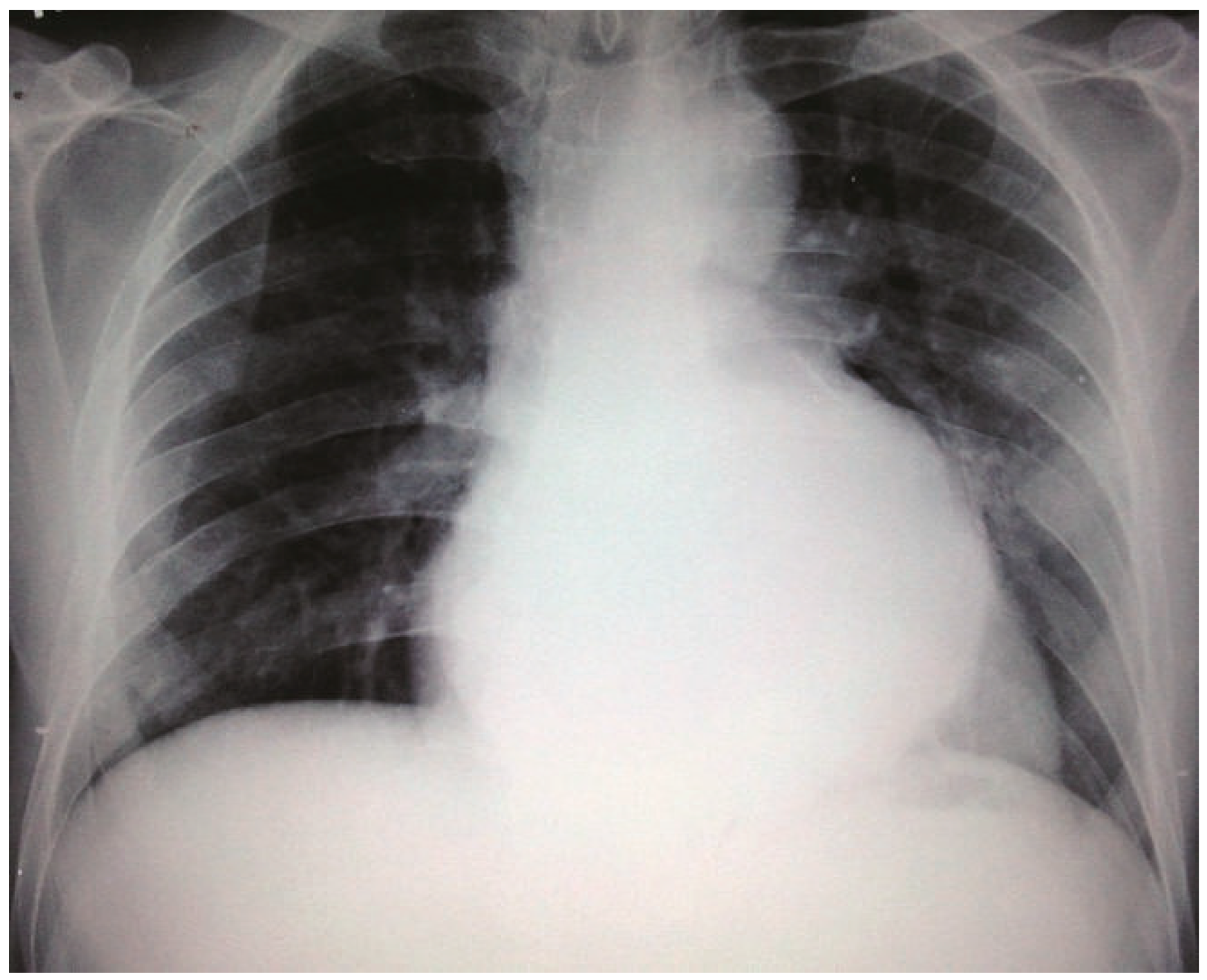 Cardiovascmed 14 00325 g001 Cardiovascmed 14 00325 g001