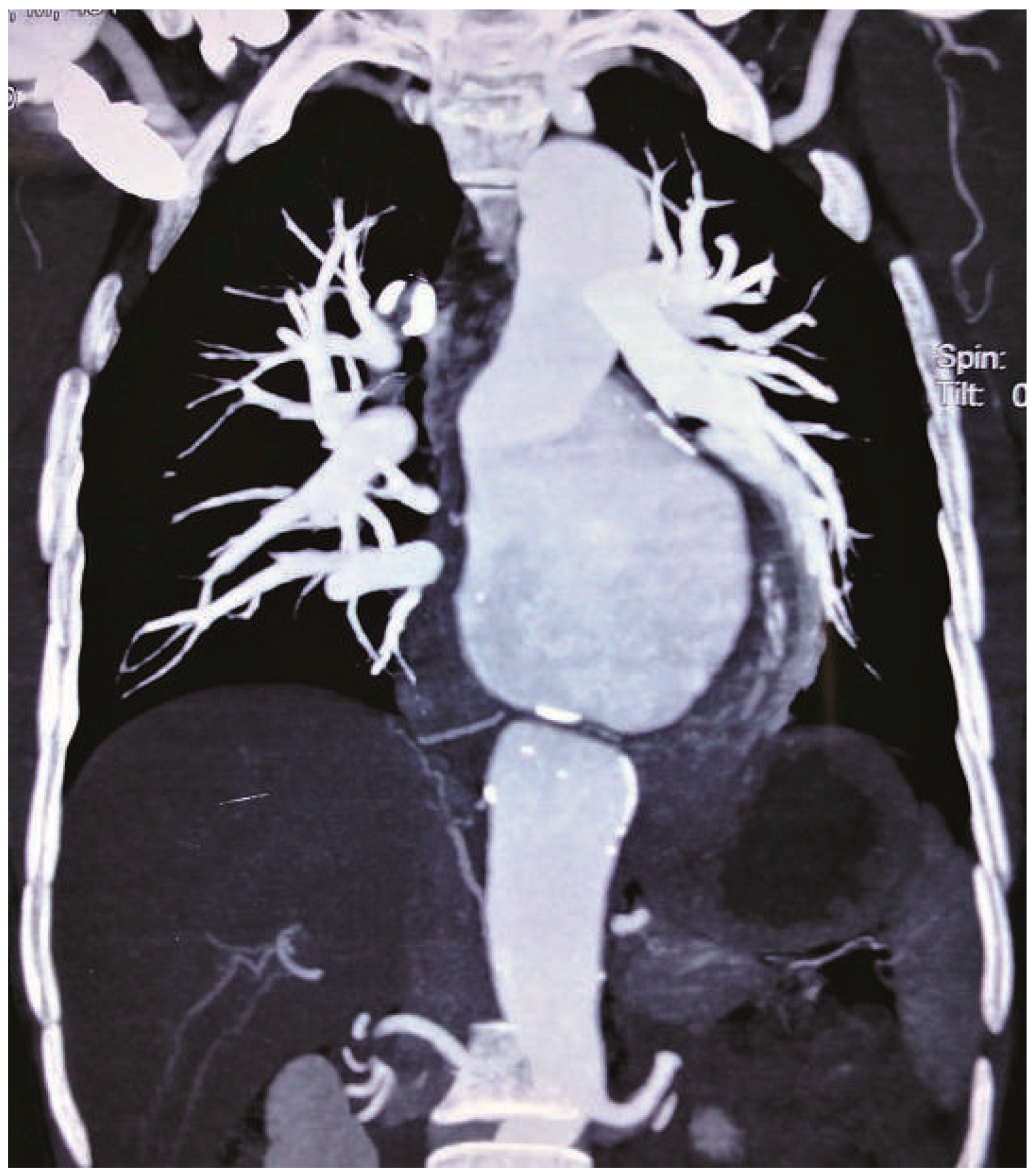 Cardiovascmed 14 00325 g002 Cardiovascmed 14 00325 g002