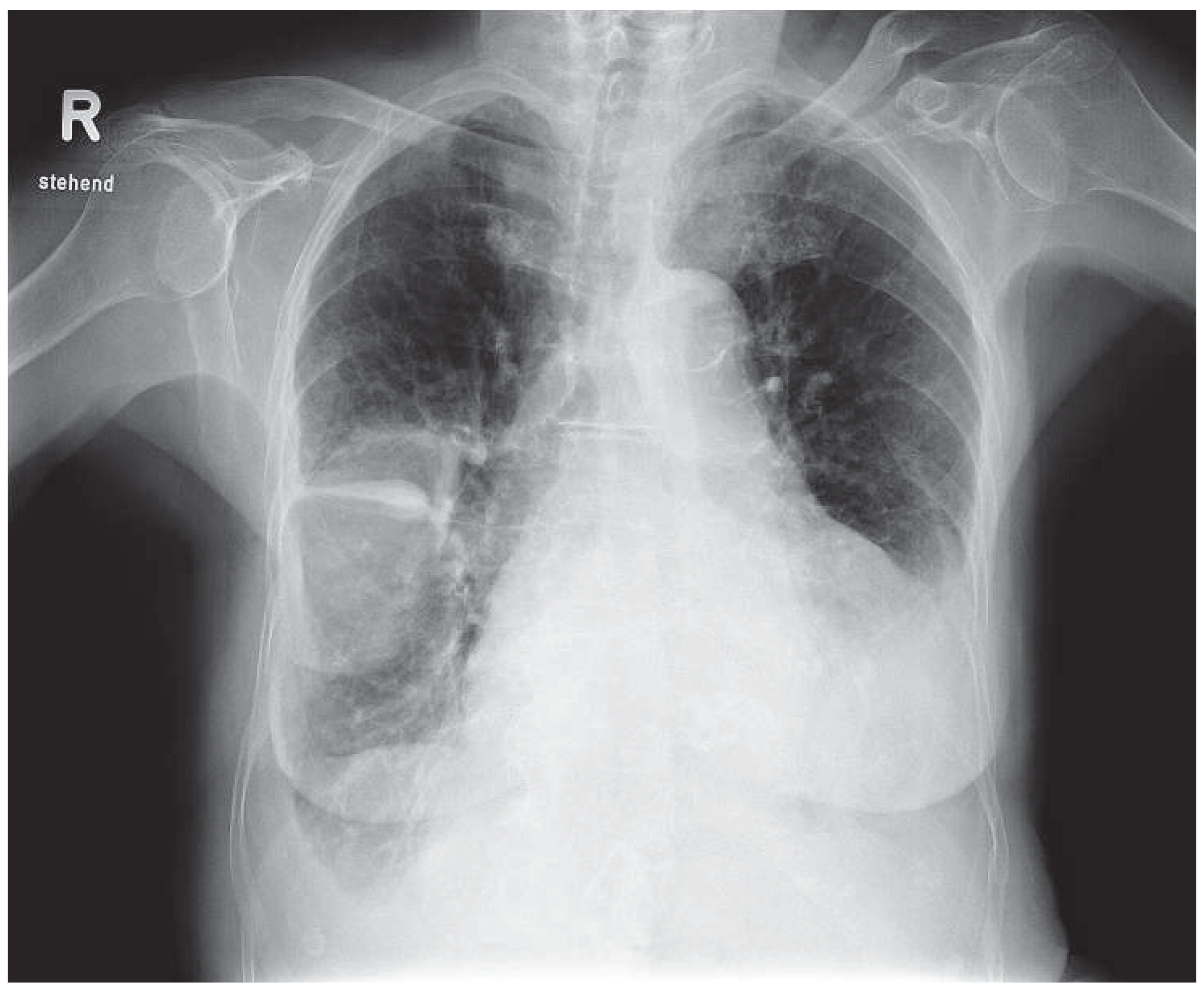 Cardiovascmed 14 00327 g001