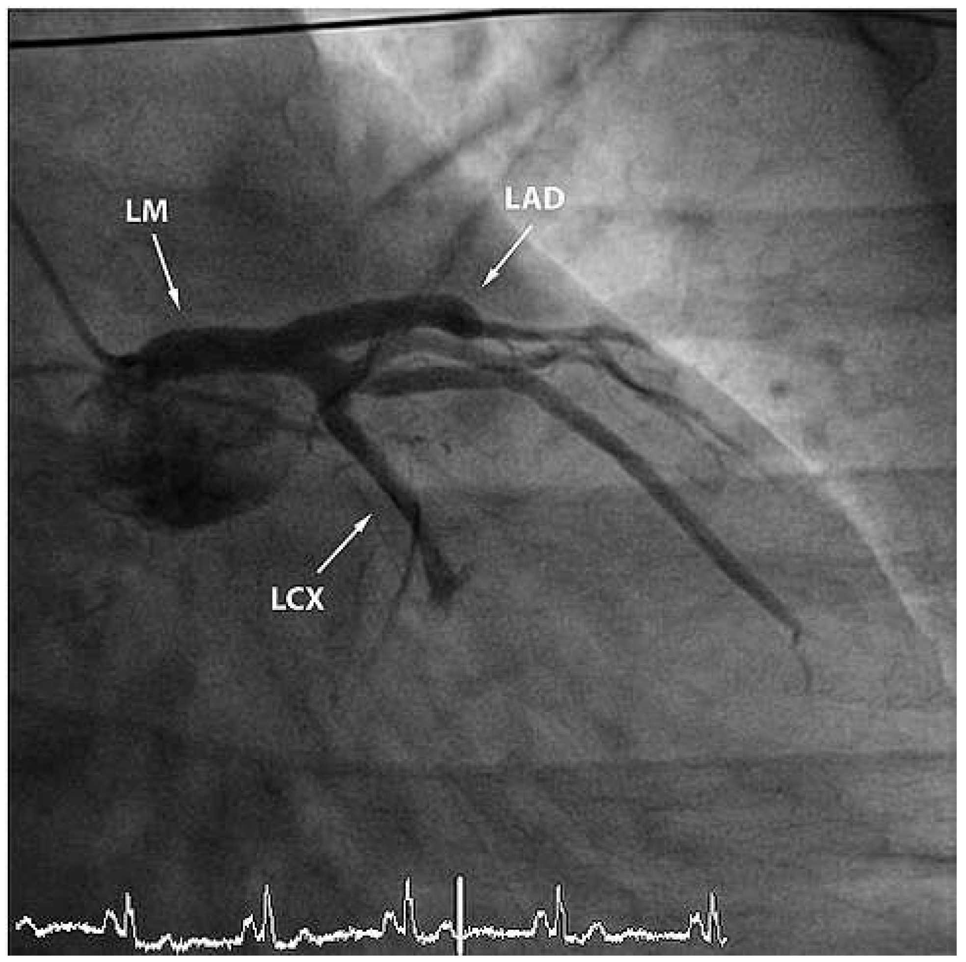 Cardiovascmed 14 00351 g002