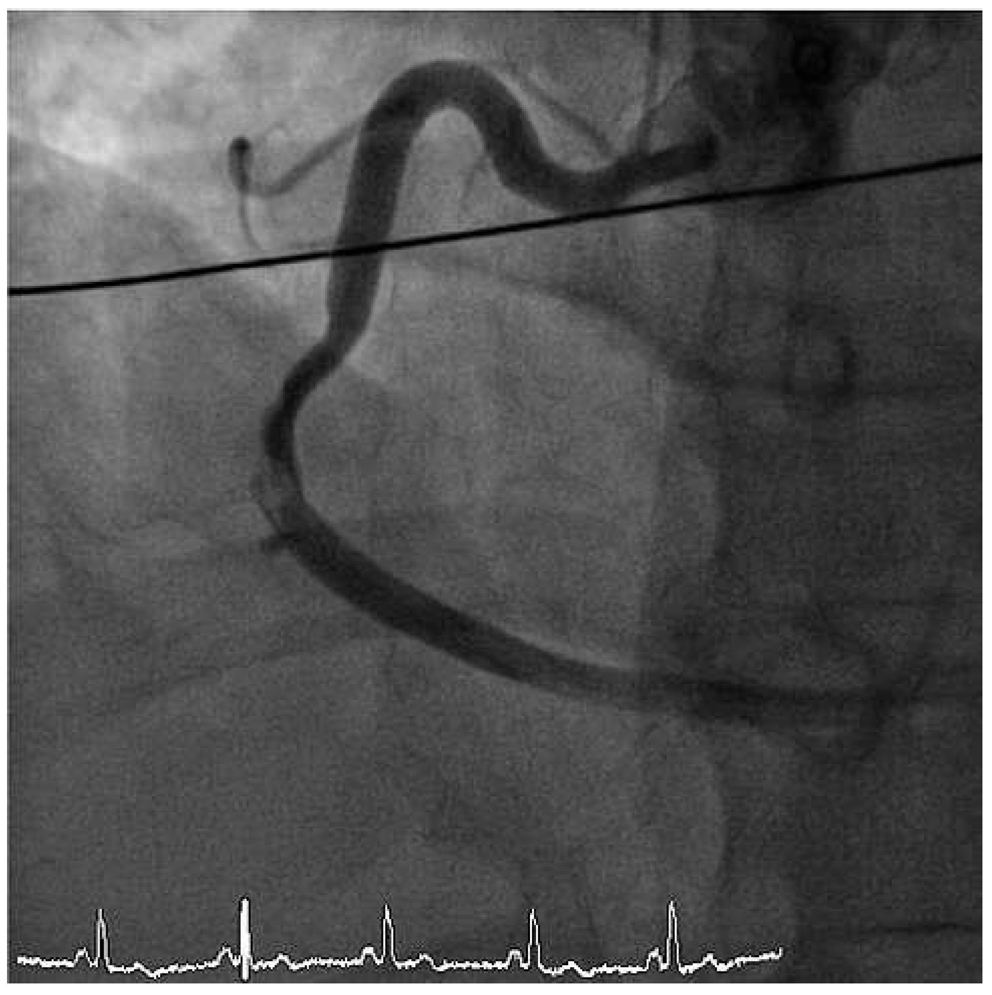 Cardiovascmed 14 00351 g003