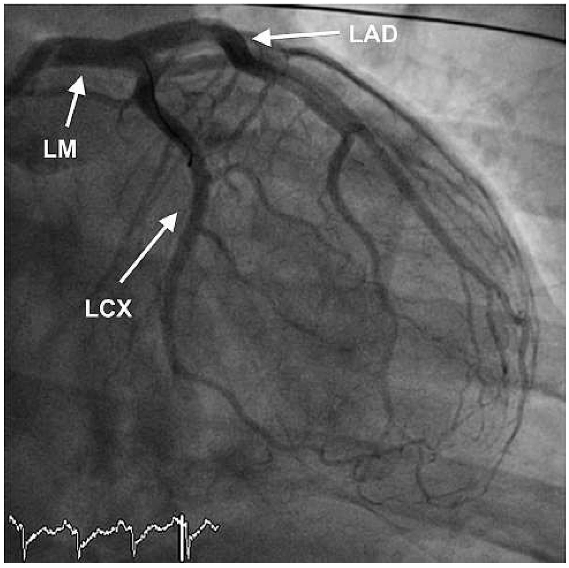 Cardiovascmed 14 00351 g004
