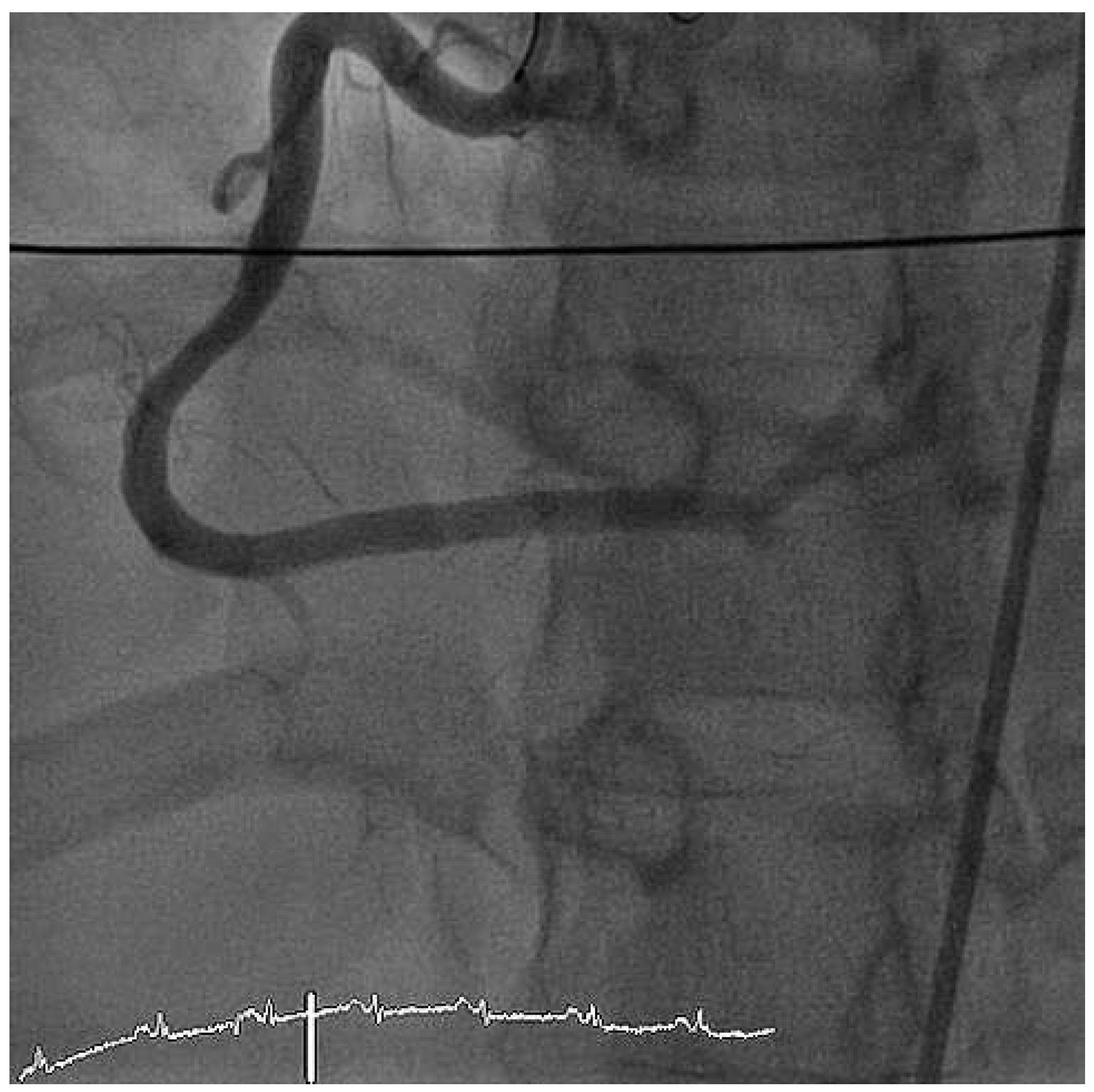 Cardiovascmed 14 00351 g005