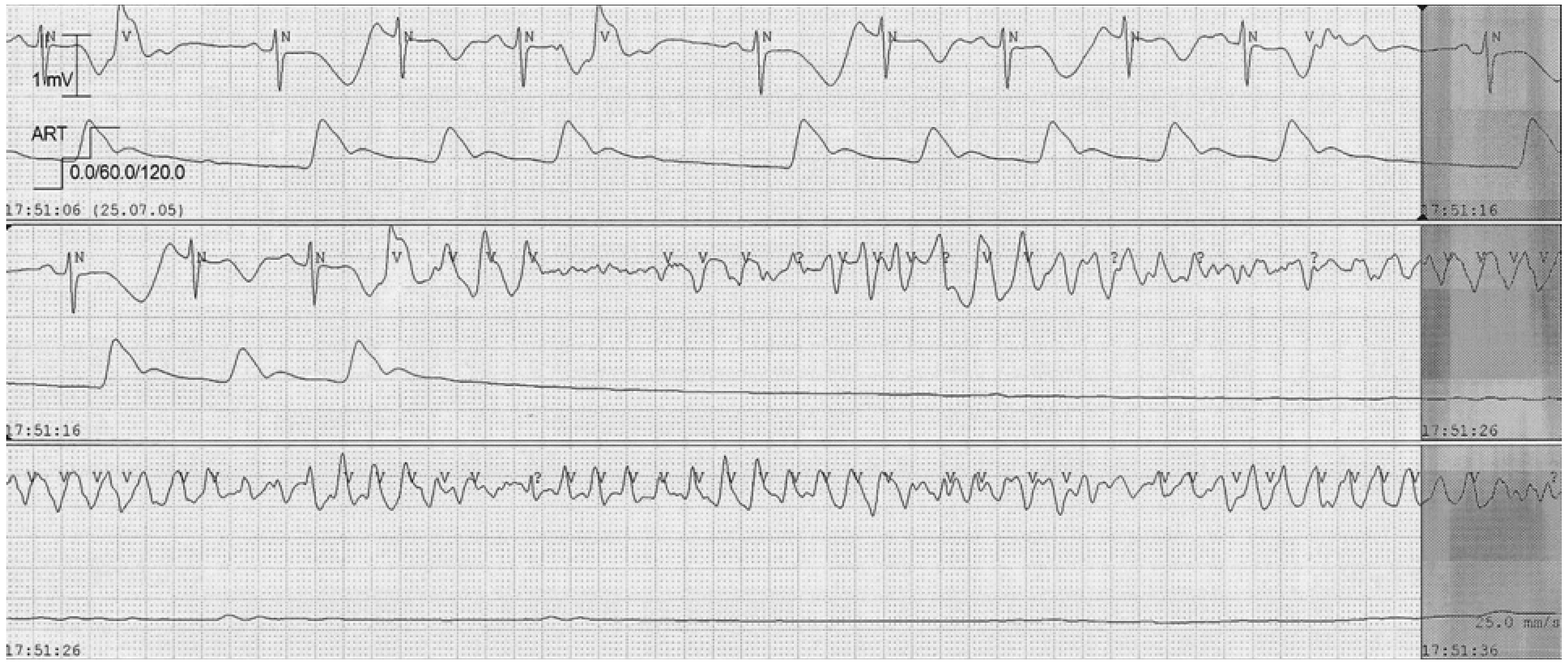 Cardiovascmed 14 00355 g002