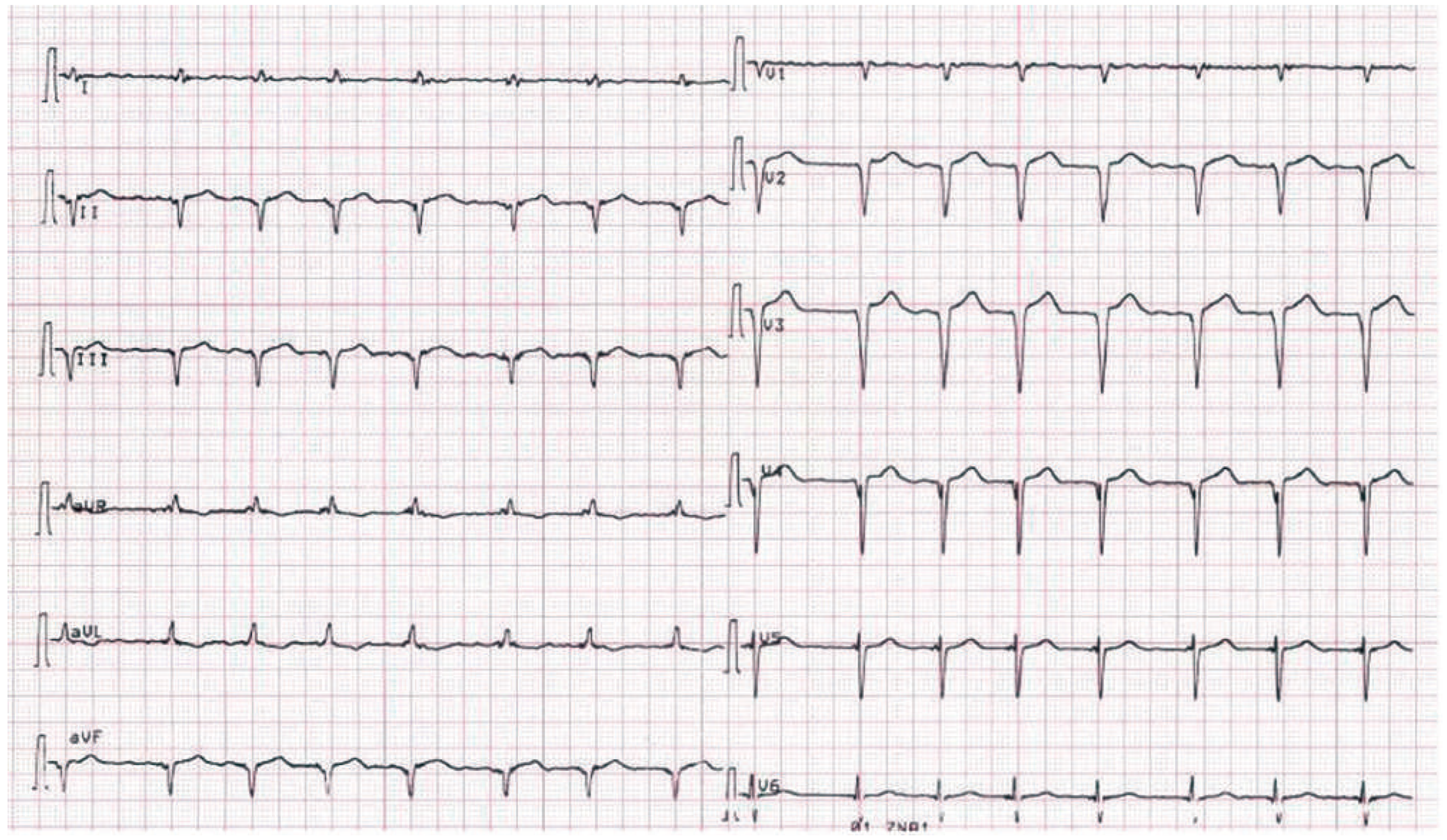 Cardiovascmed 15 00030 g001