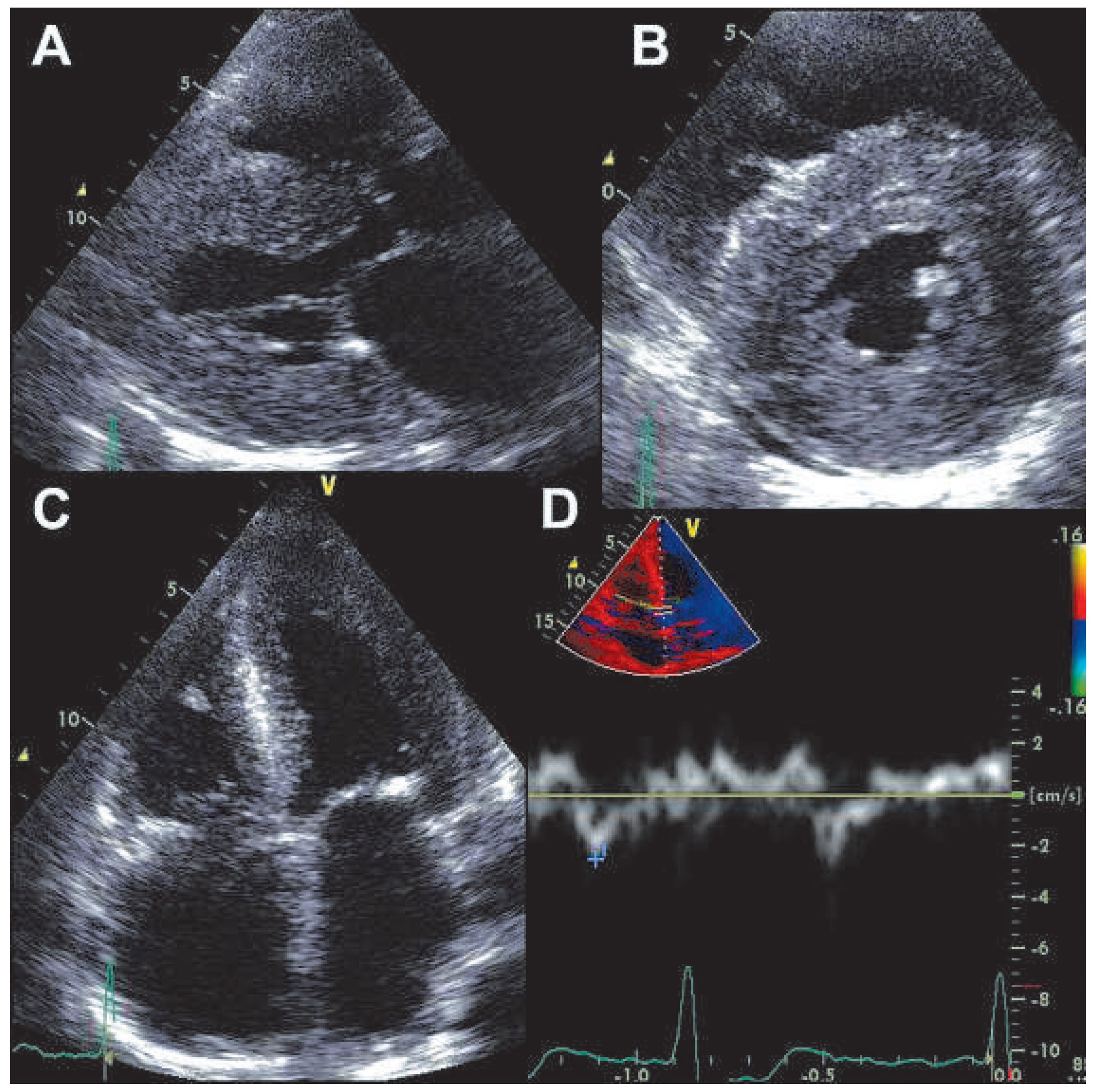 Cardiovascmed 15 00030 g002