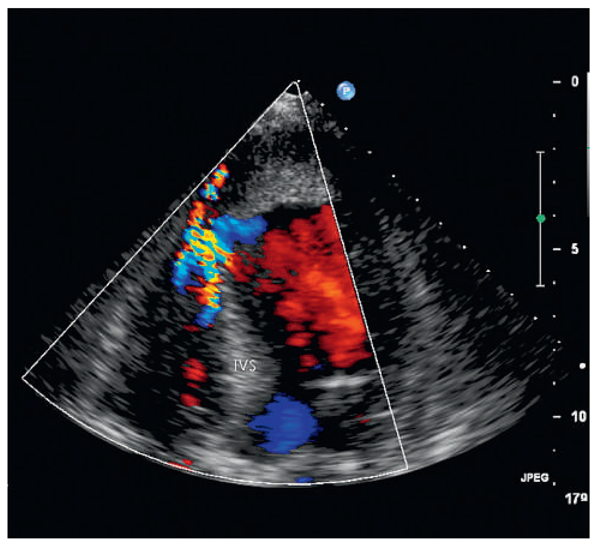 Cardiovascmed 15 00101 g002