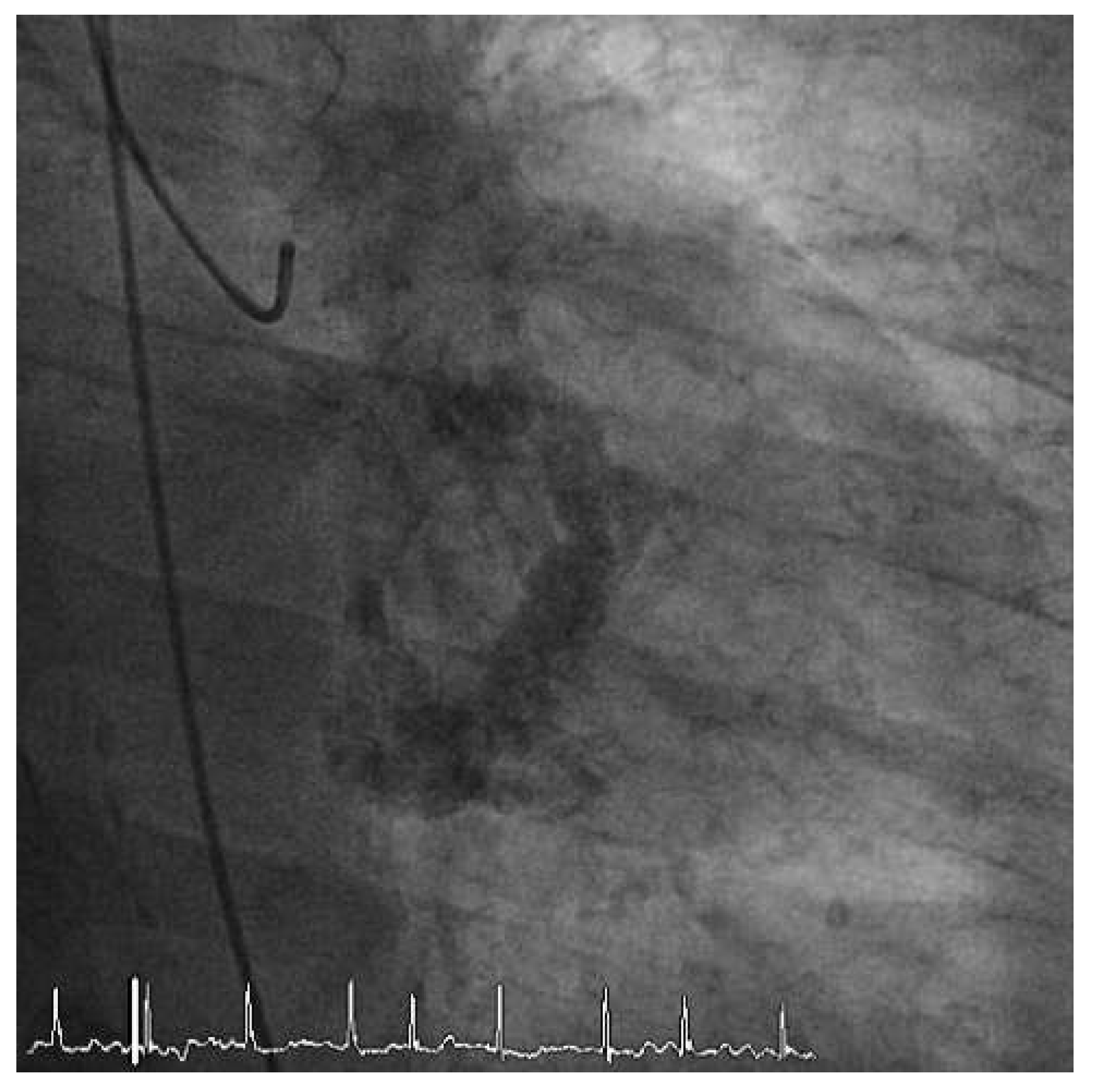 Cardiovascmed 15 00202 g001