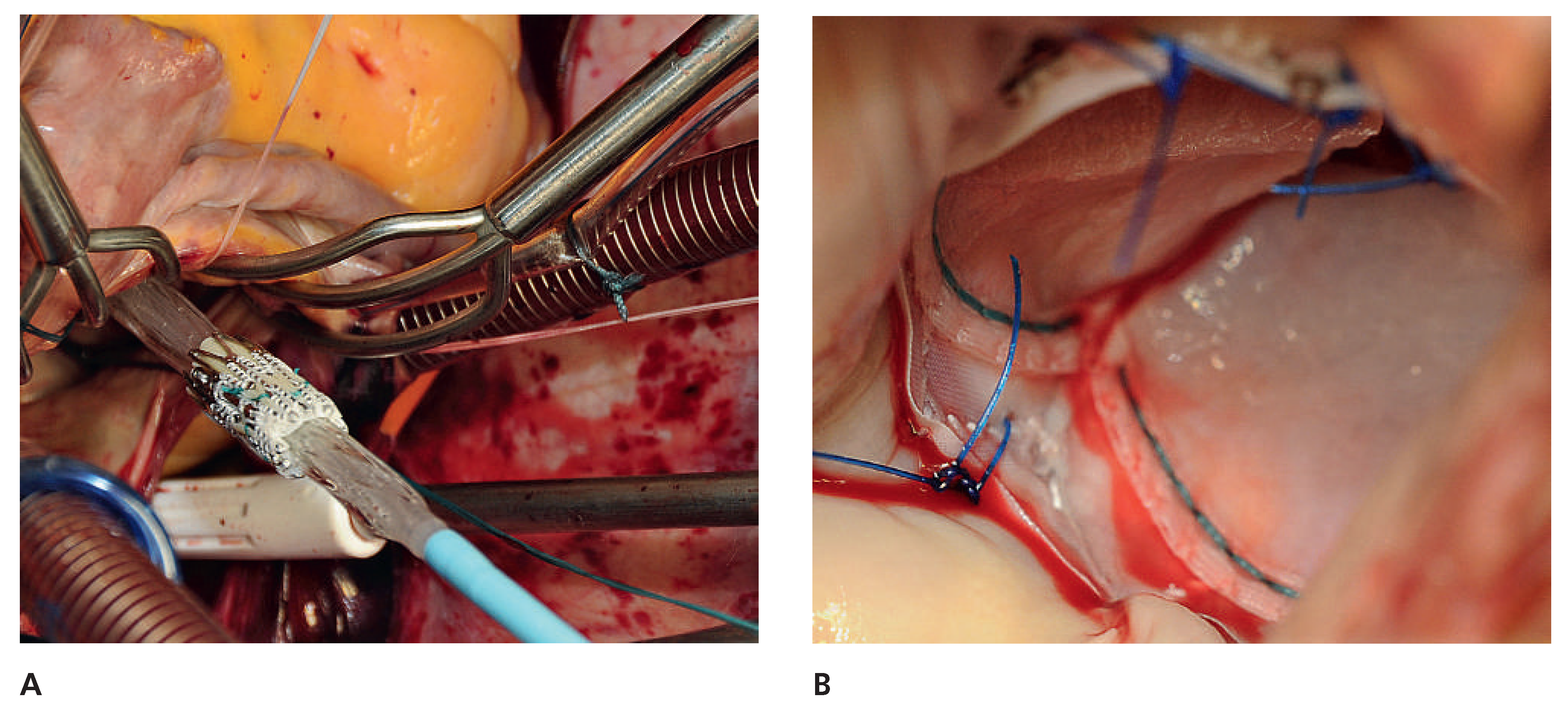 Cardiovascmed 15 00202 g002