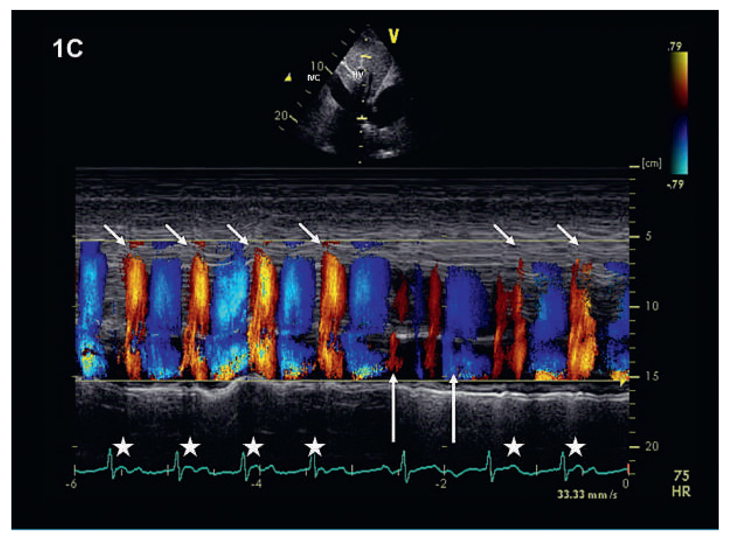 Cardiovascmed 15 00206 g003