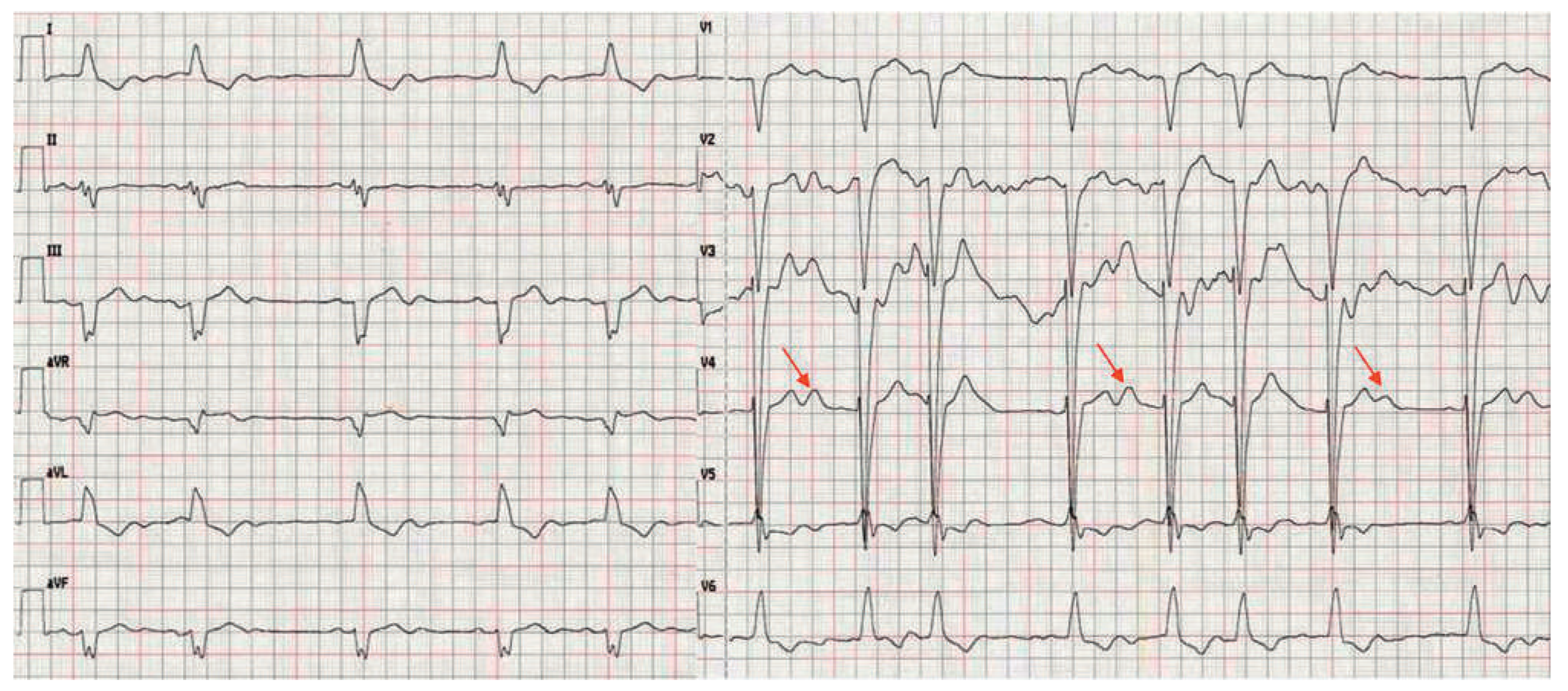 Cardiovascmed 15 00208 g001