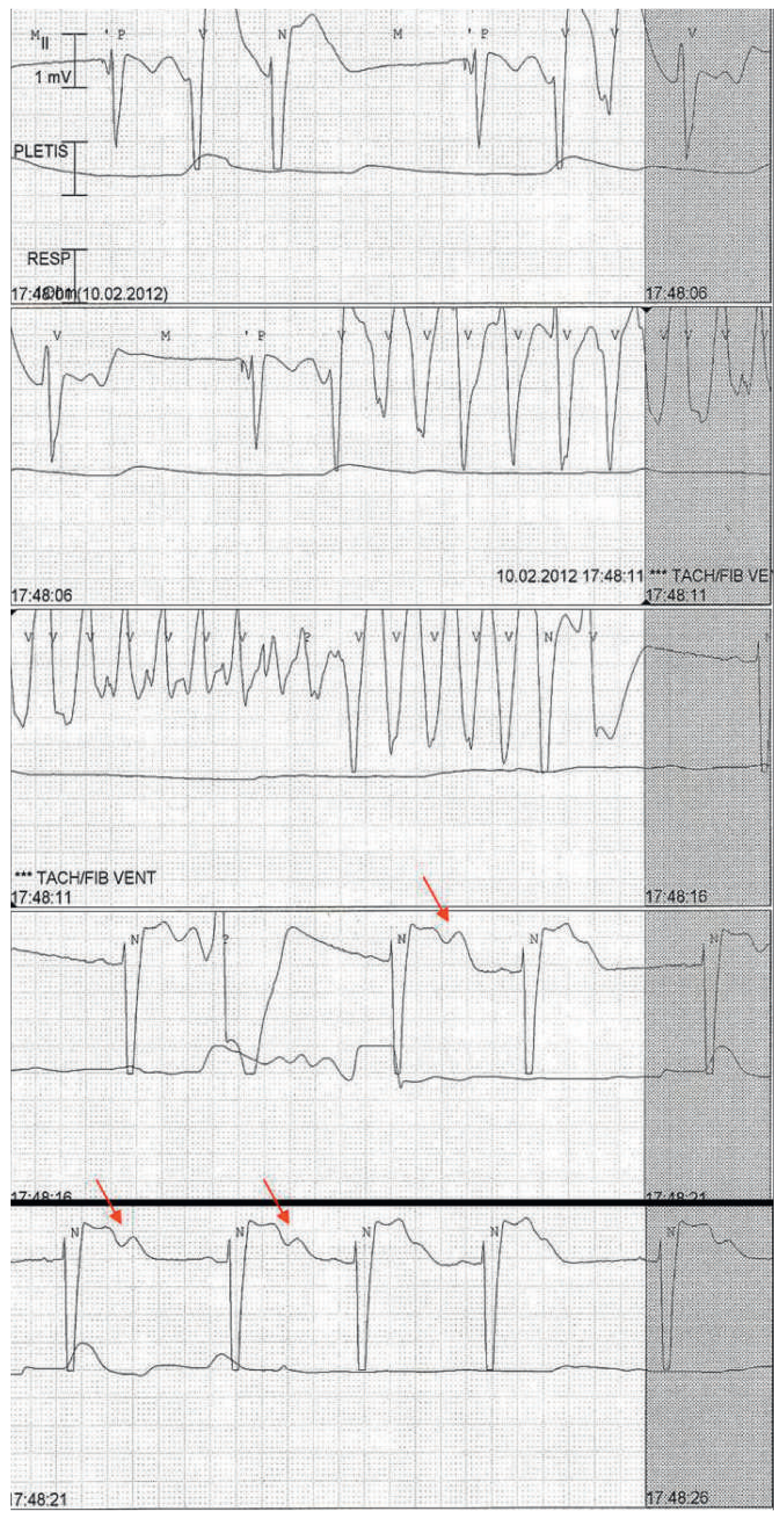 Cardiovascmed 15 00208 g002