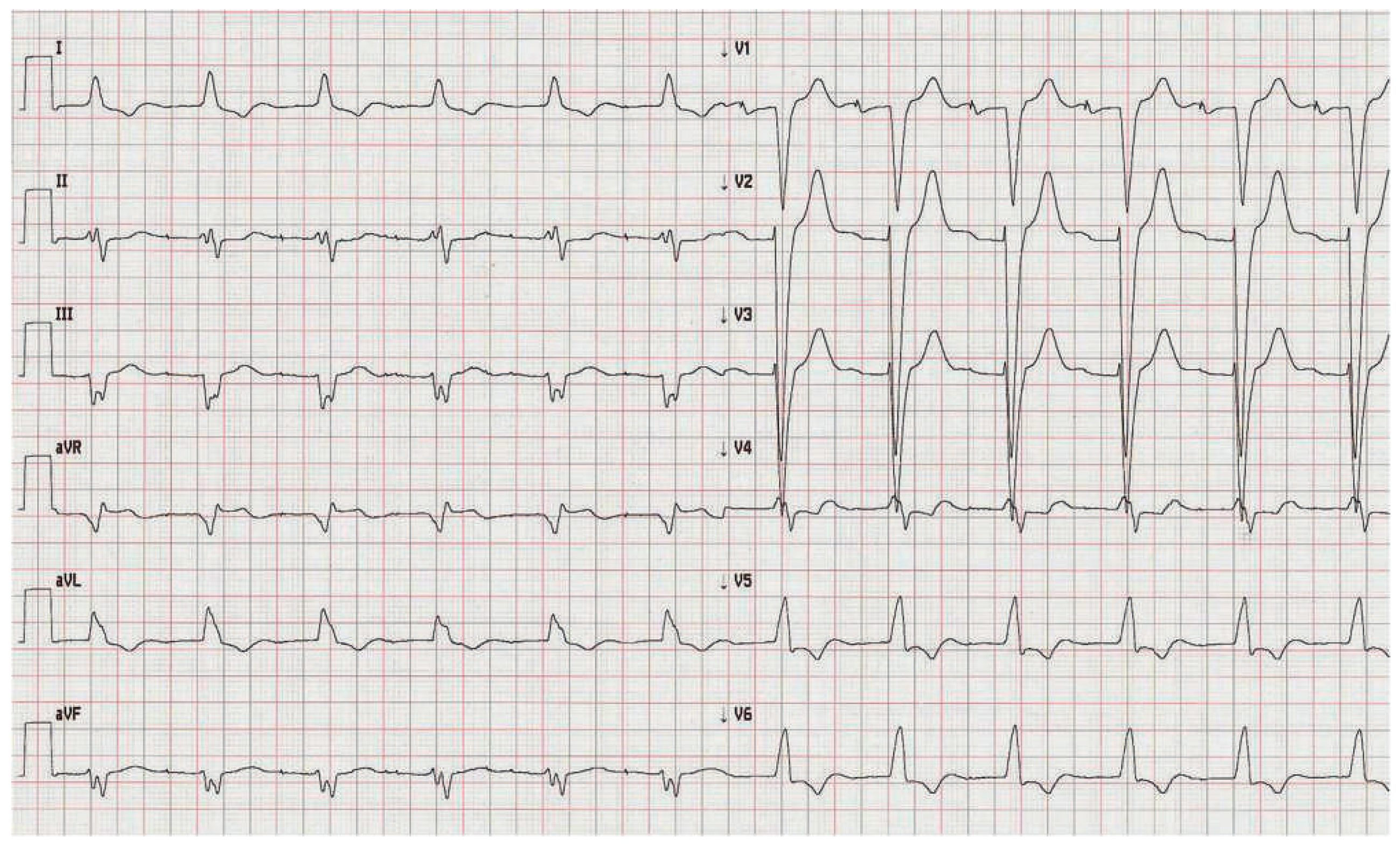 Cardiovascmed 15 00208 g003
