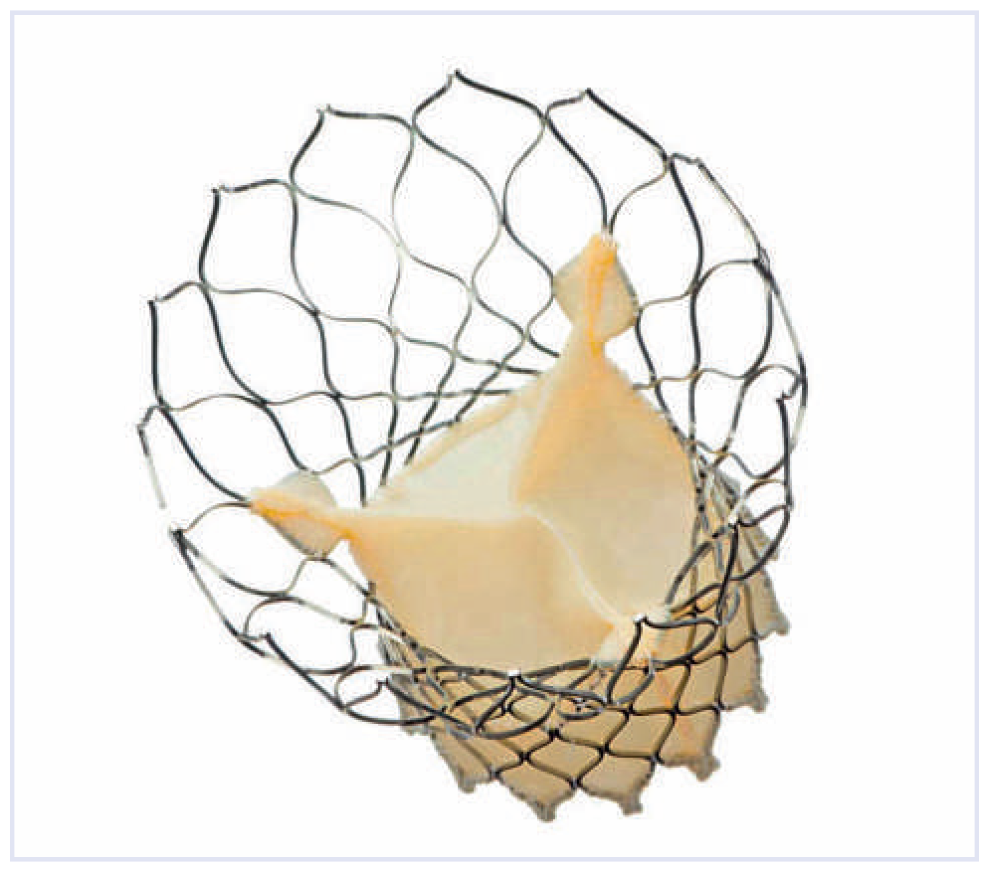 Cardiovascmed 15 00213 g002