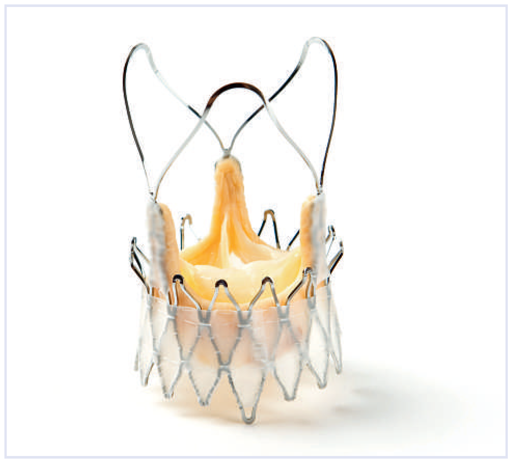 Cardiovascmed 15 00213 g003