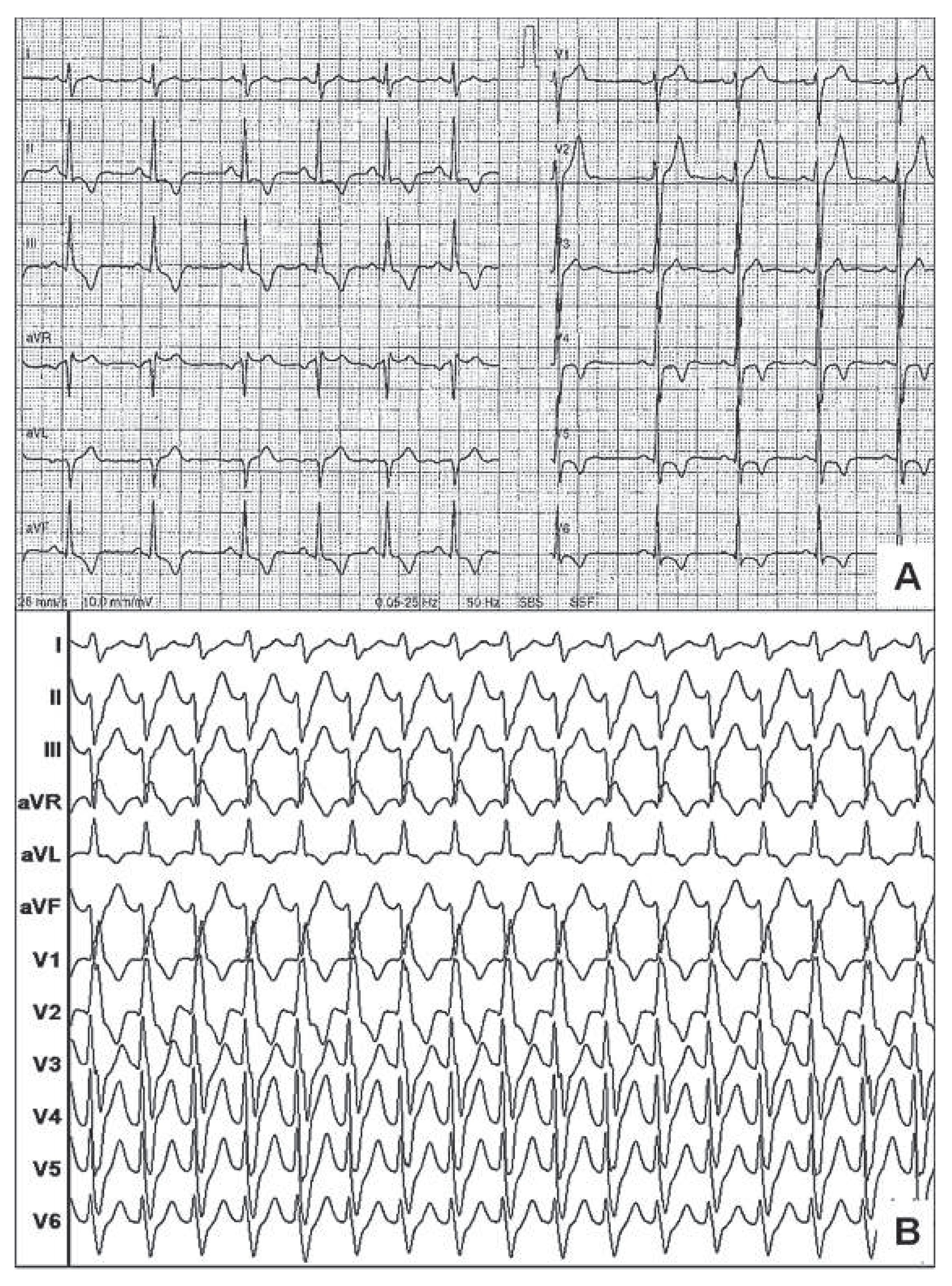 Cardiovascmed 15 00224 g001