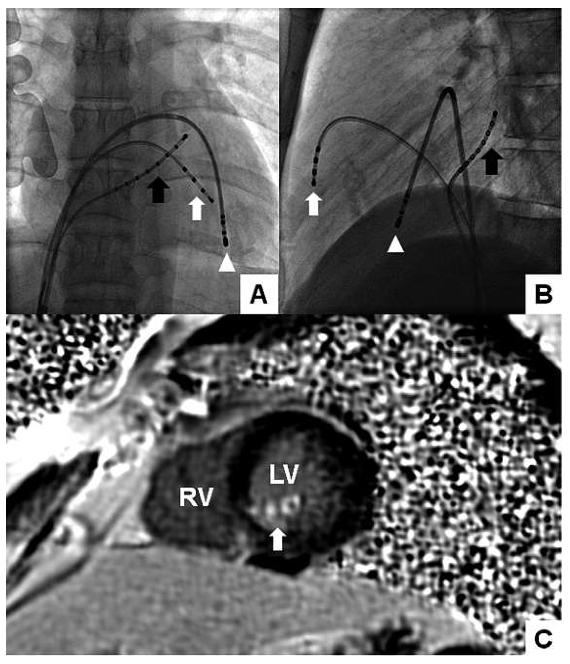 Cardiovascmed 15 00224 g002