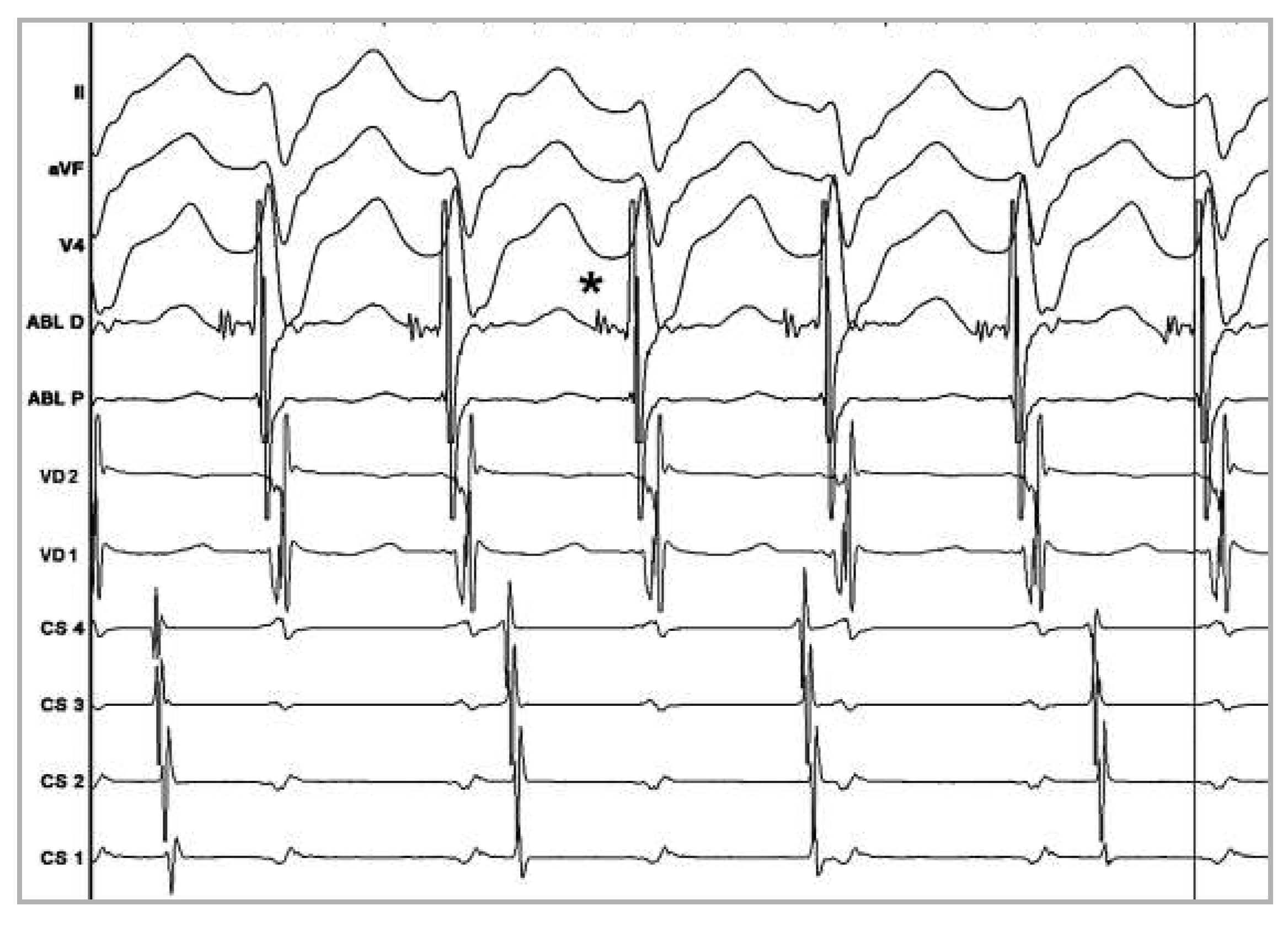 Cardiovascmed 15 00224 g003
