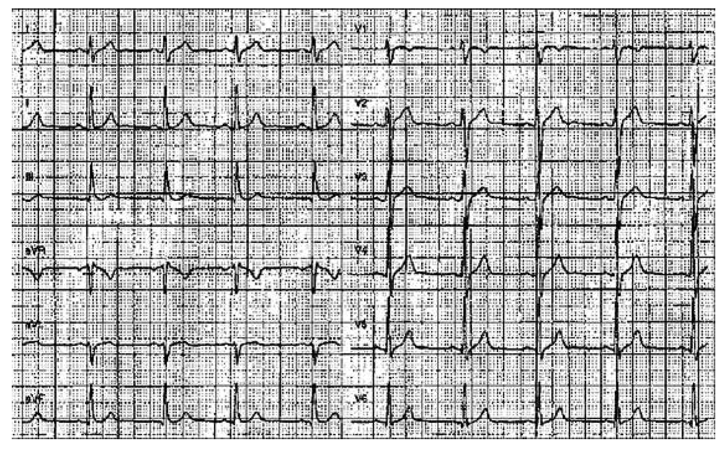 Cardiovascmed 15 00224 g004