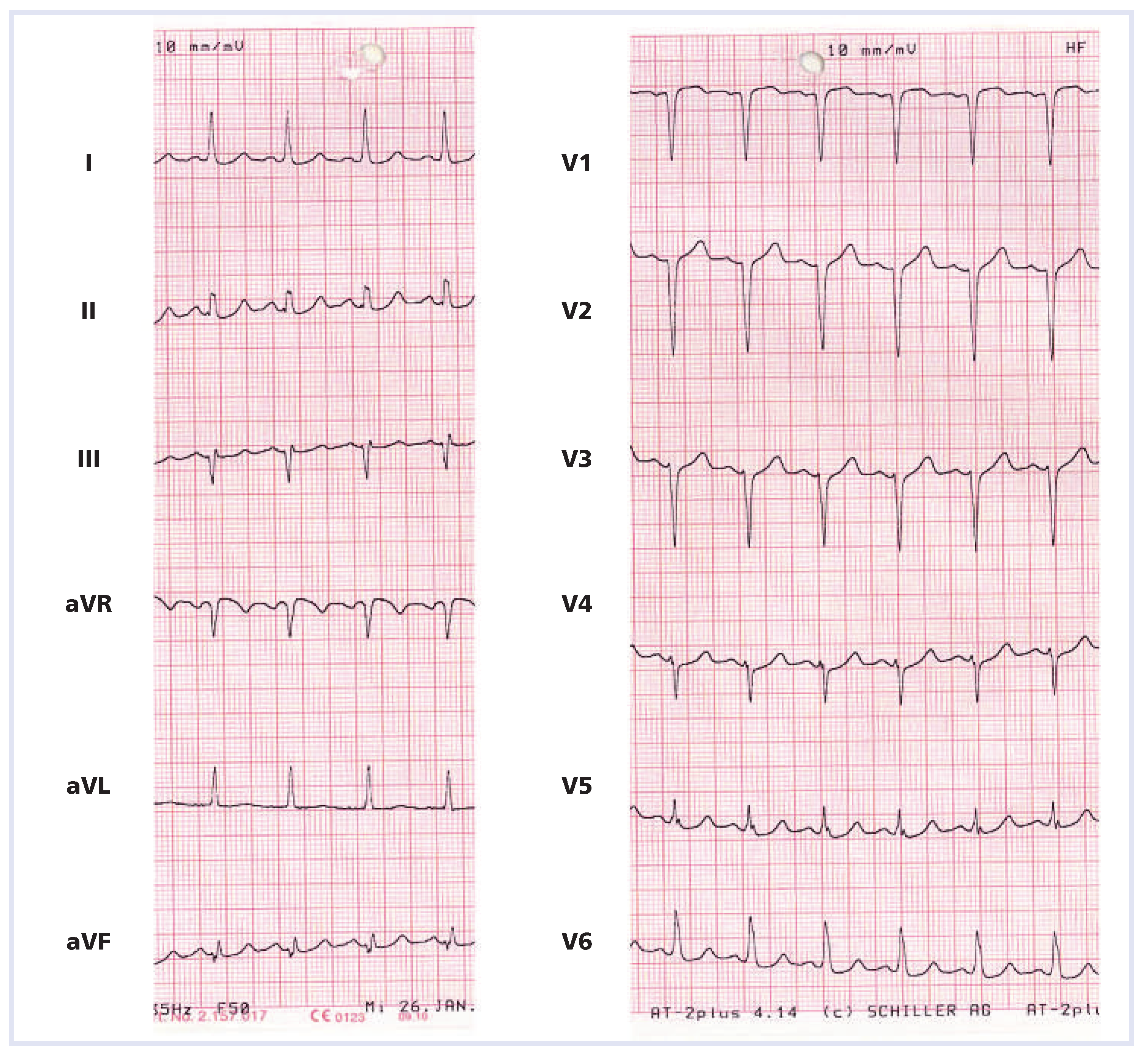 Cardiovascmed 15 00230 g001