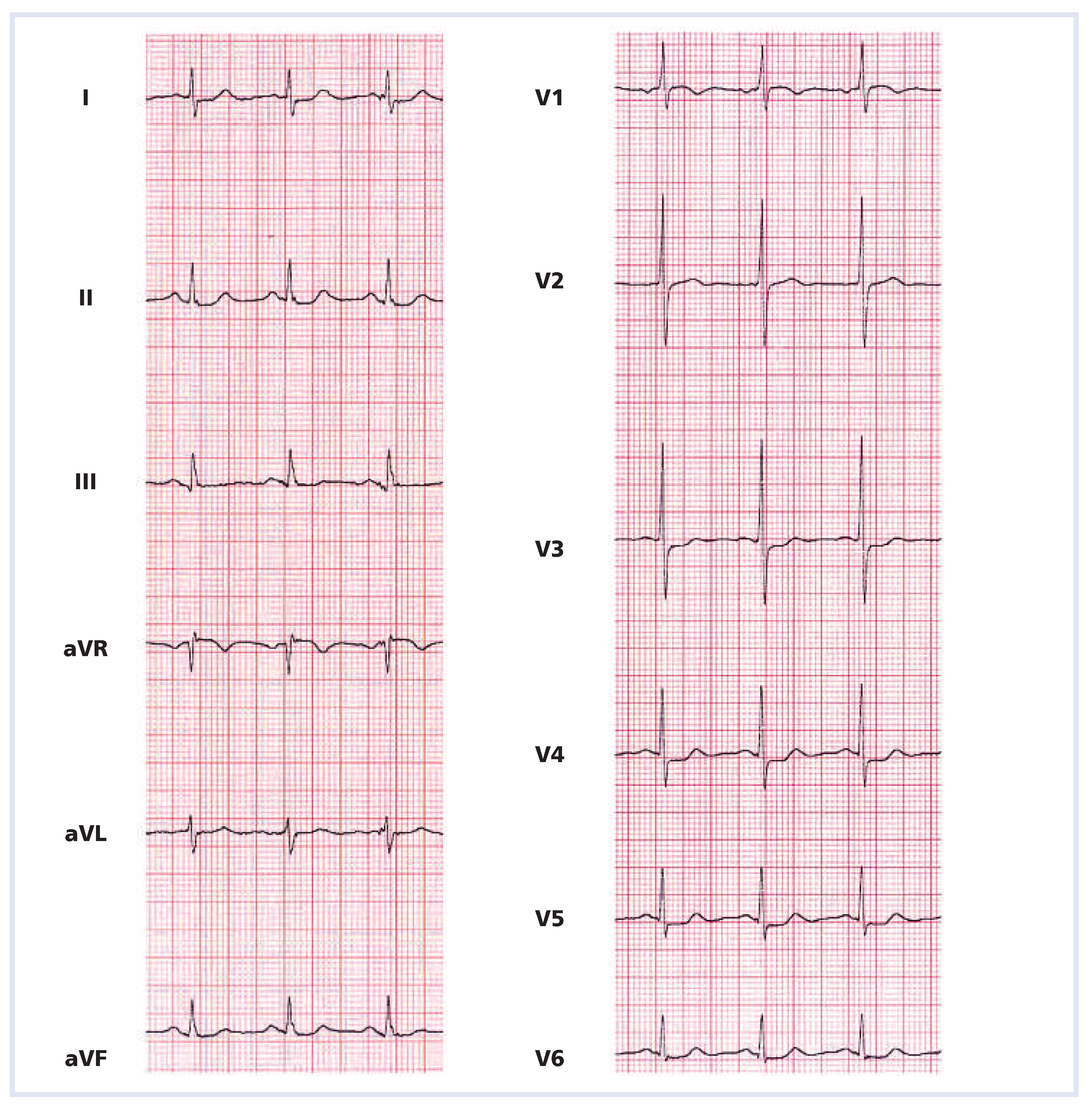 Cardiovascmed 15 00230 g002