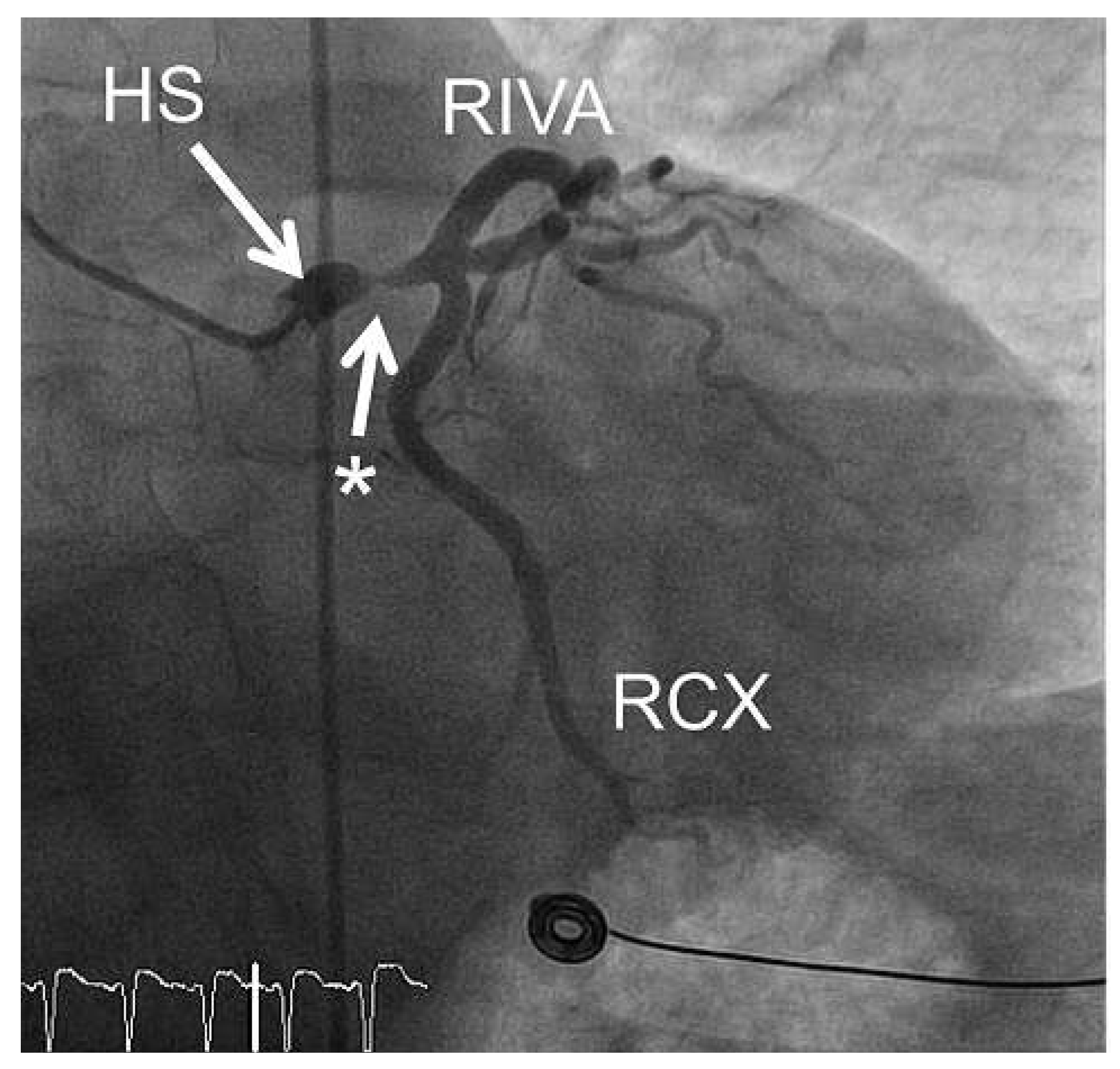 Cardiovascmed 15 00230 g003
