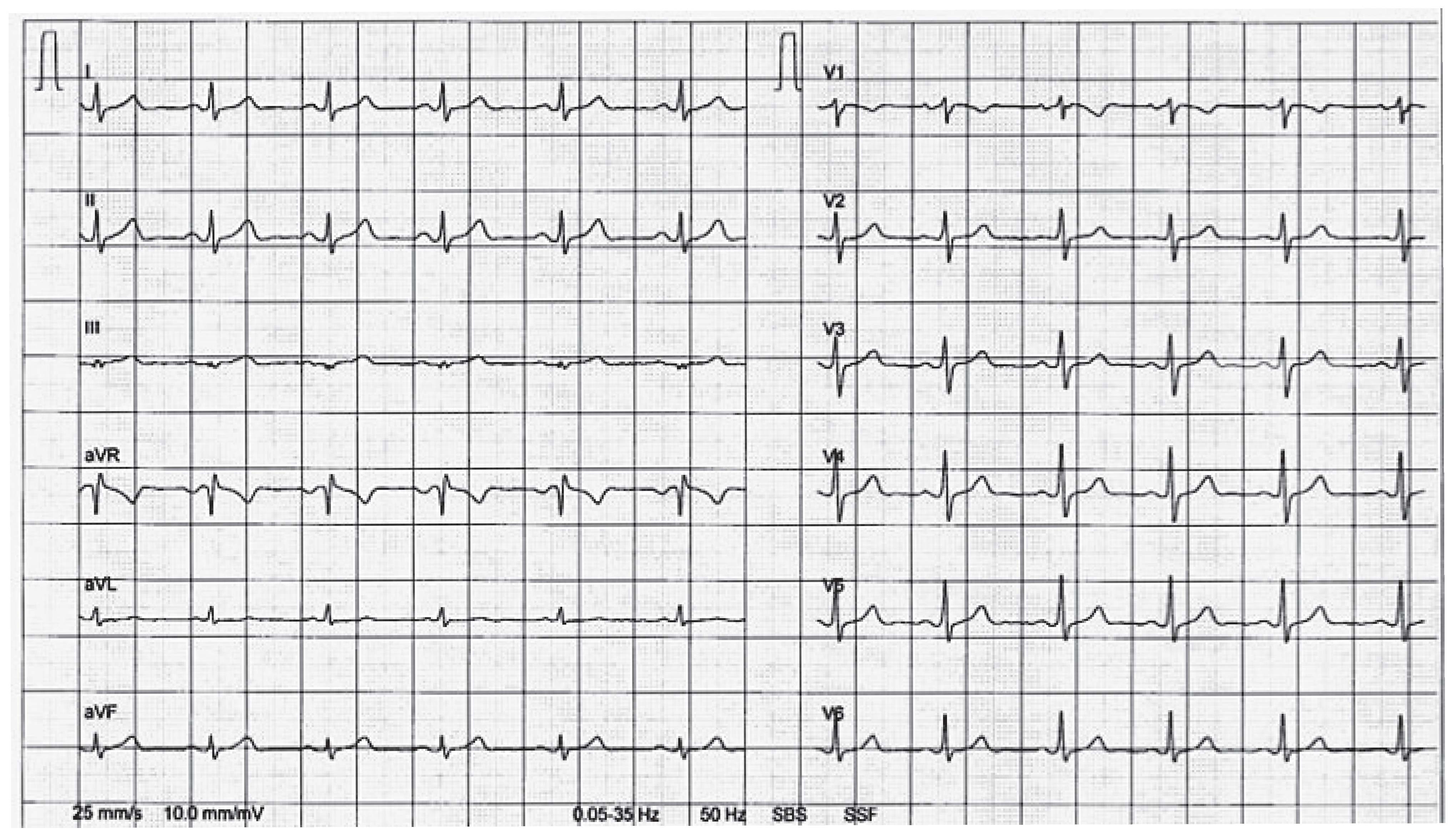 Cardiovascmed 15 00233 g001